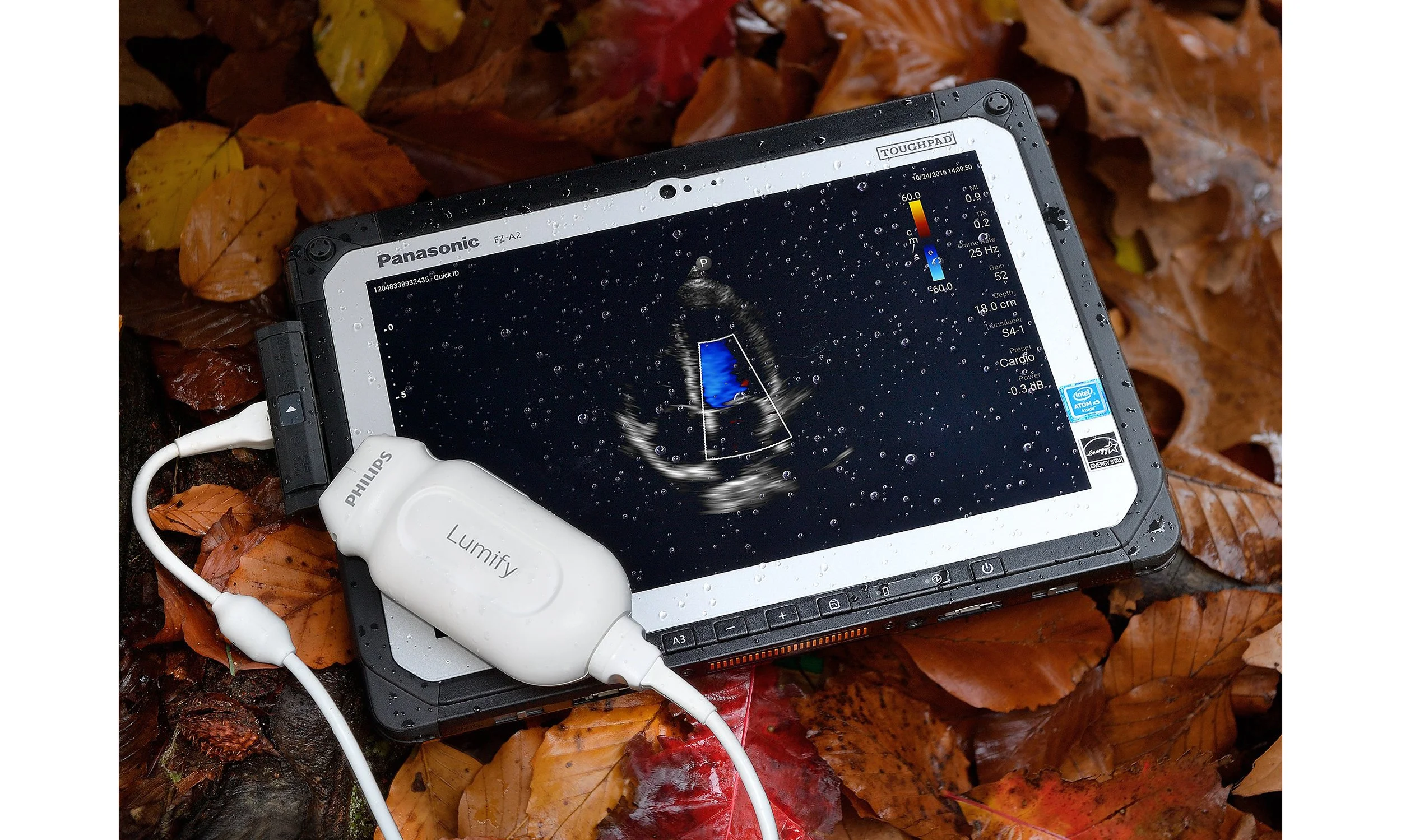 Point-of-care Ultrasound in Primary Care