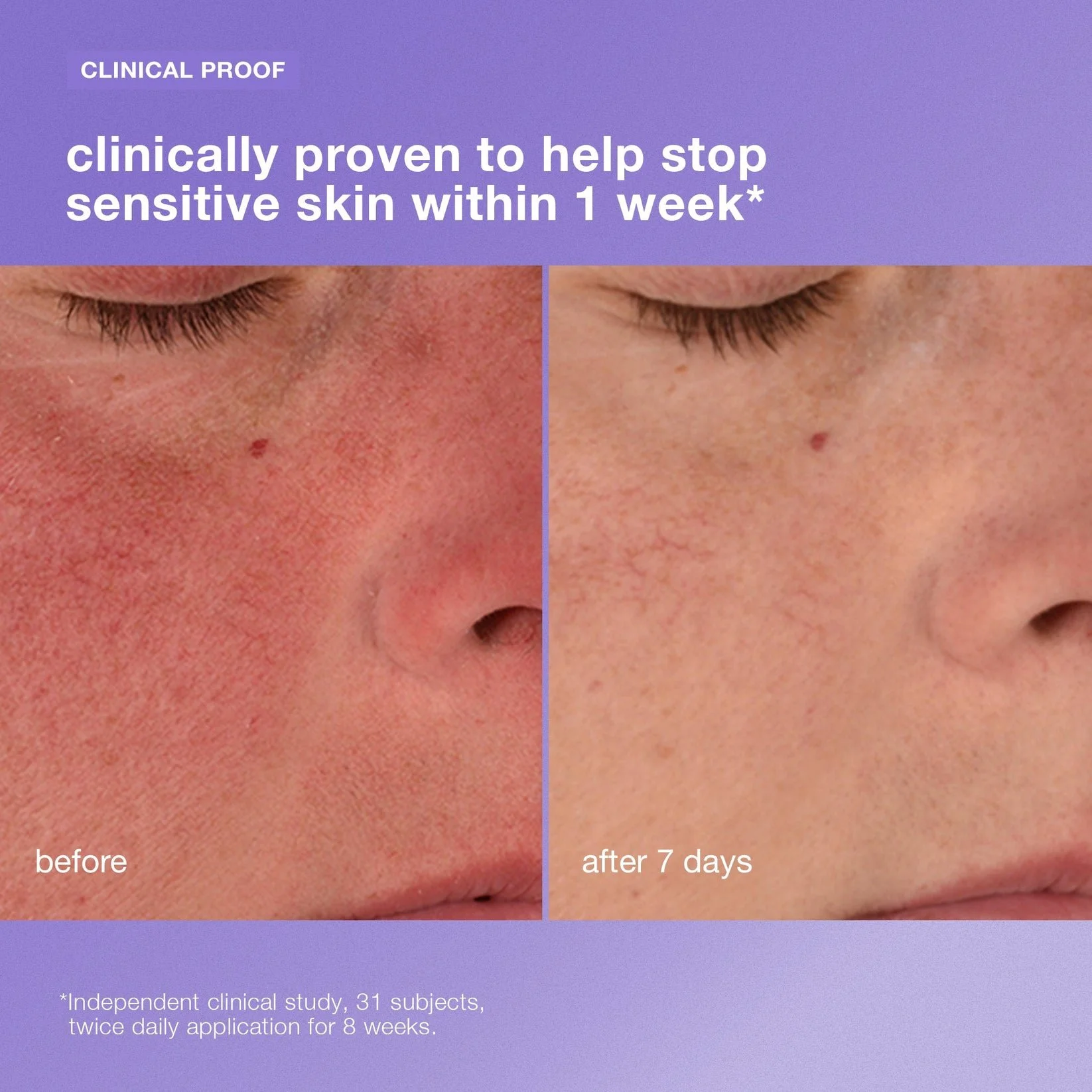 StabilizingRepairCream_Clinical_aef1be37-e898-42d8-b76b-67fec47400be.jpg