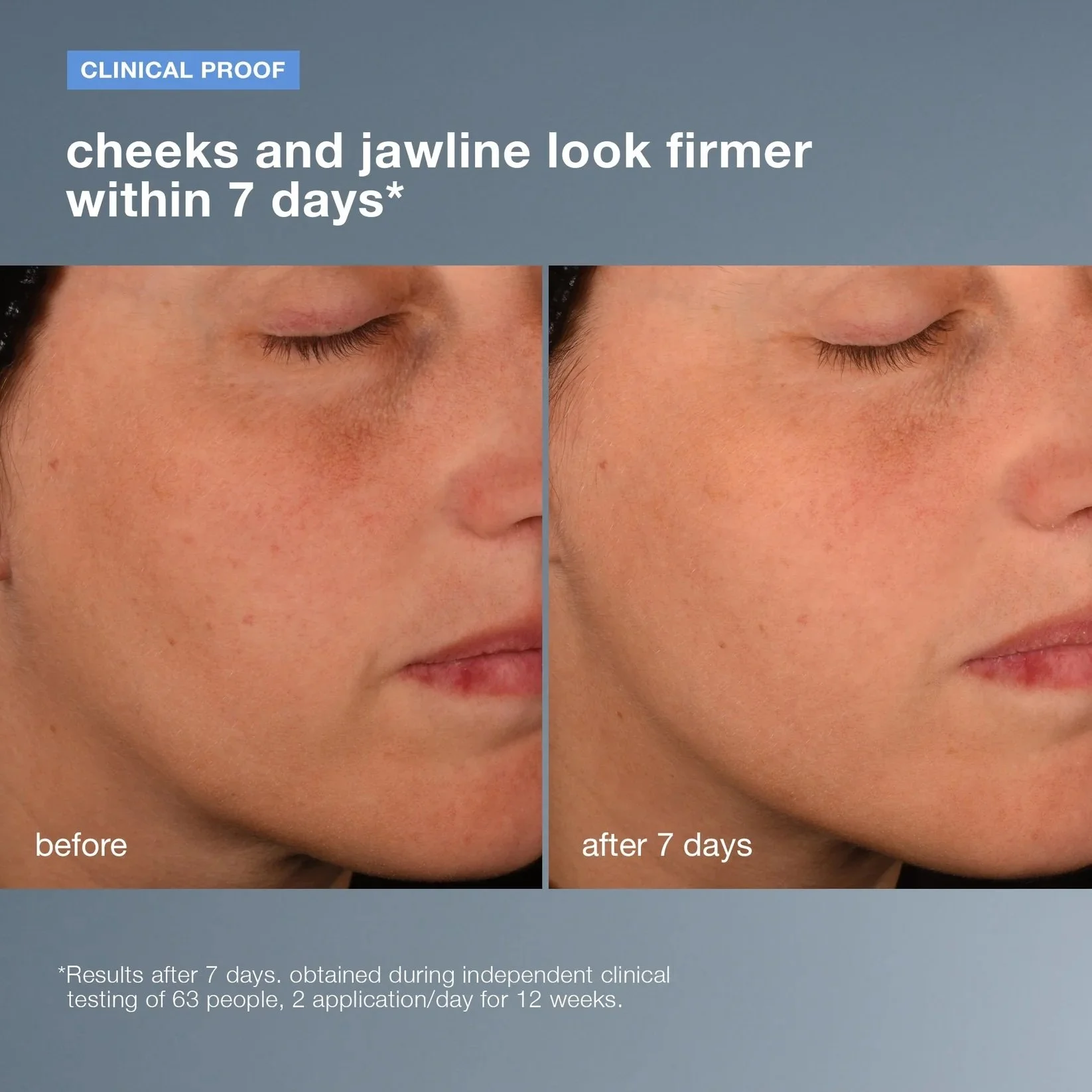Pro-CollagenBankingSerum_Clinical.jpg.jpeg