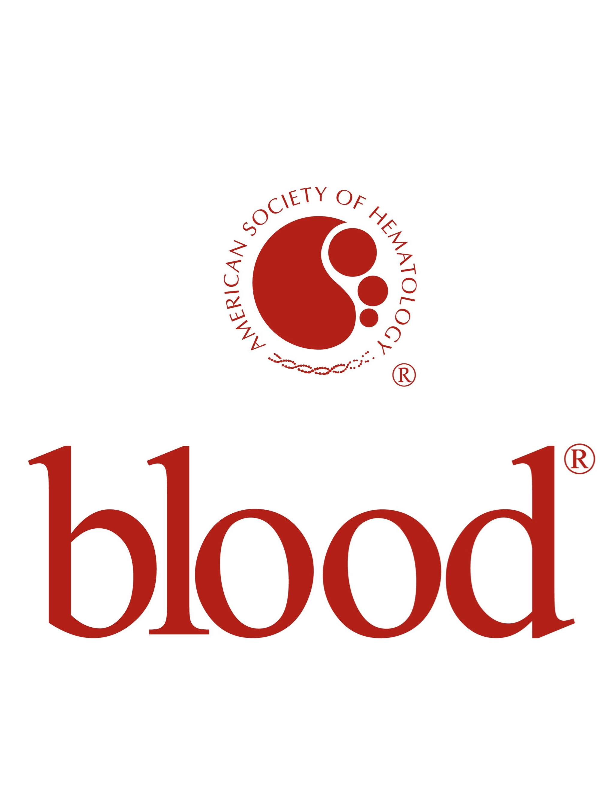 Lisocabtagene maraleucel combined with ibrutinib in R/R CLL or SLL: primary results from TRANSCEND CLL 004, Blood, 2026