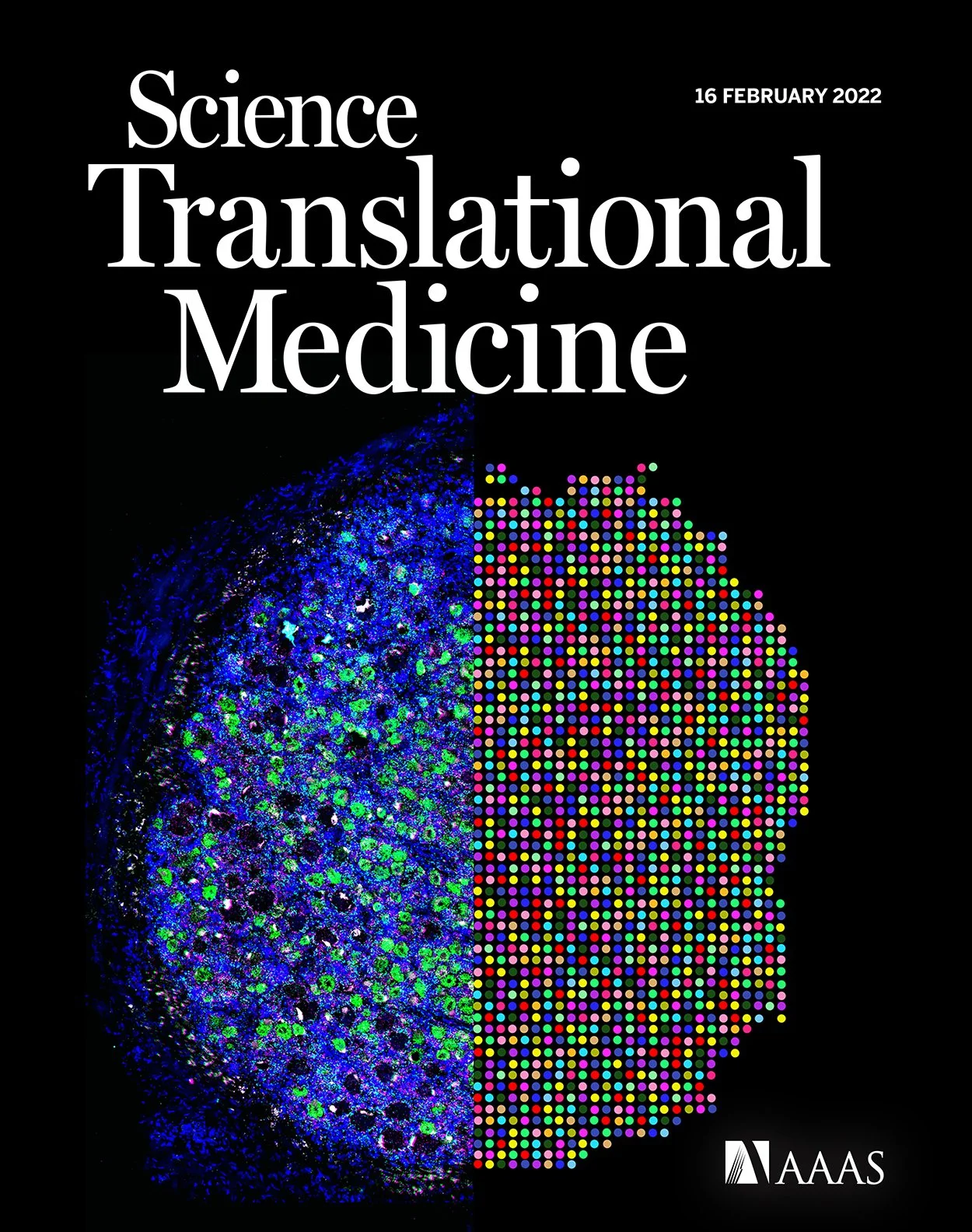 Spatial transcriptomics reveals unique molecular fingerprints of human nociceptors. Science Transl Medicine, 2022
