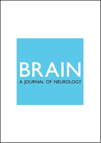 Review Studying human nociceptors: from fundamentals to the clinic. Brain, 2021