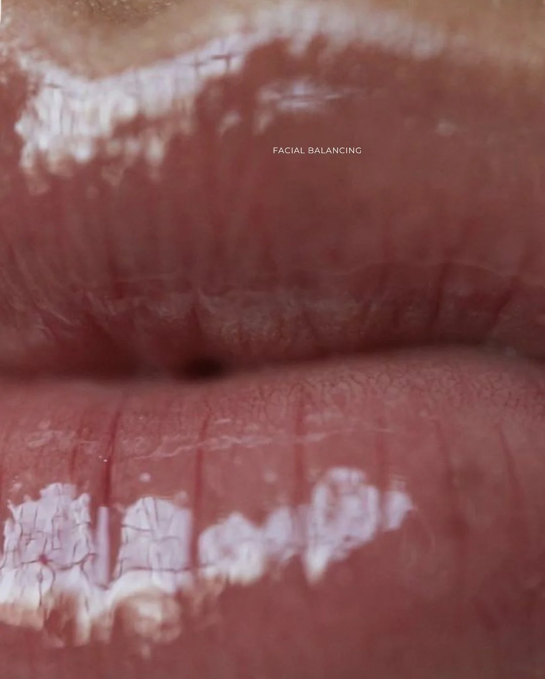 Facial Balancing By Nurse Erin

At Haus of Skinn Aesthetics, creating a balanced and refined facial profile begins with a detailed understanding of facial proportions. One of the tools we use to guide this process is the Ricketts line, which provides