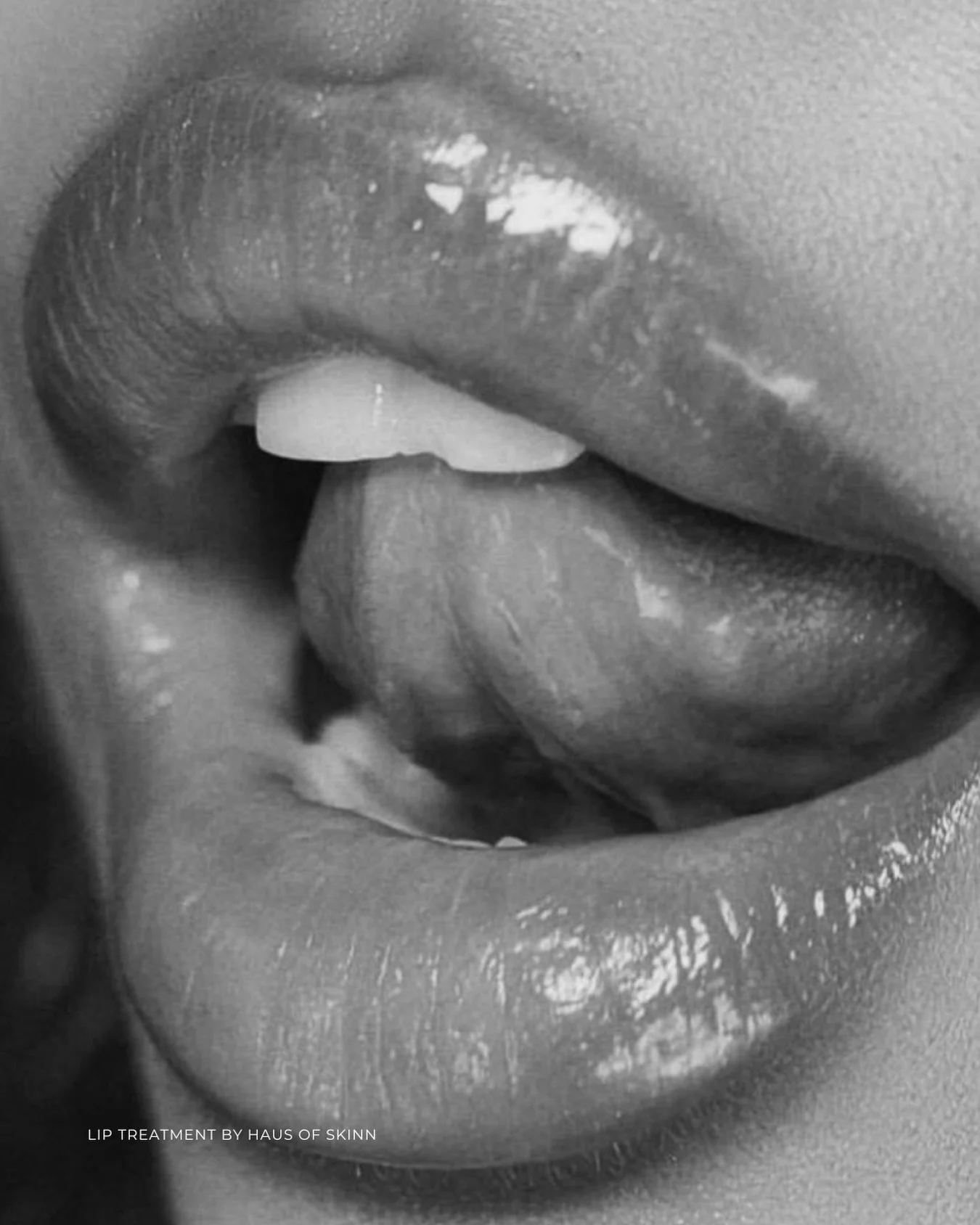 At Haus of Skinn, we pride ourselves on delivering a truly unique, carefully curated and precise lip treatment experience. Every detail of our approach has been refined over hours, days, weeks, months and years to create a technique we are genuinely 