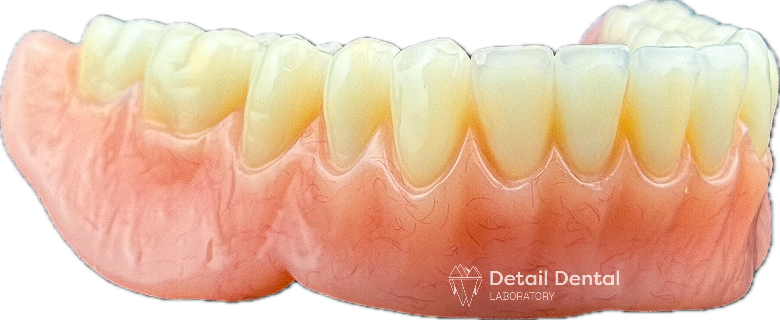 A detailed dental model showing upper teeth and gums with the logo of Detail Dental Laboratory in the bottom right corner.