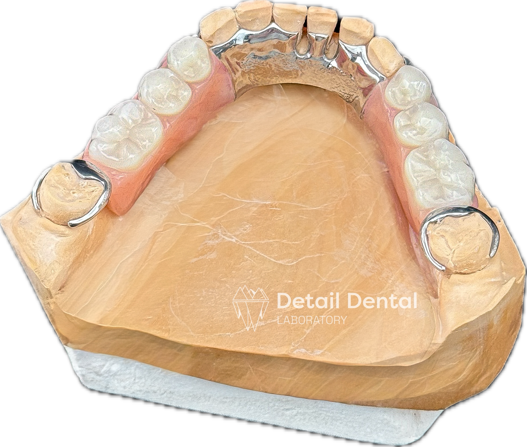 A dental model of the upper jaw showing teeth, some with dental crowns and metal clasps, on a black background with 'Detail Dental Laboratory' text.