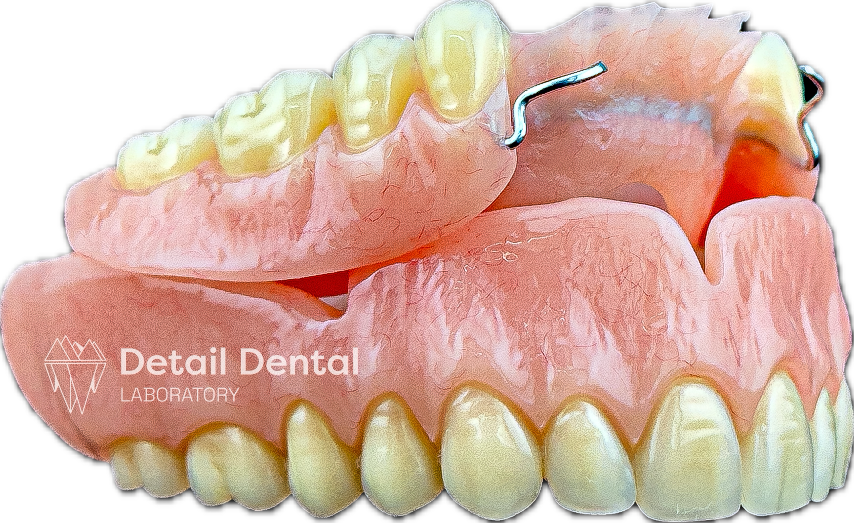 Close-up of a dental prosthetic model showing upper and lower teeth with a partial denture, metal clasp, and pink gum-colored base, against a black background.