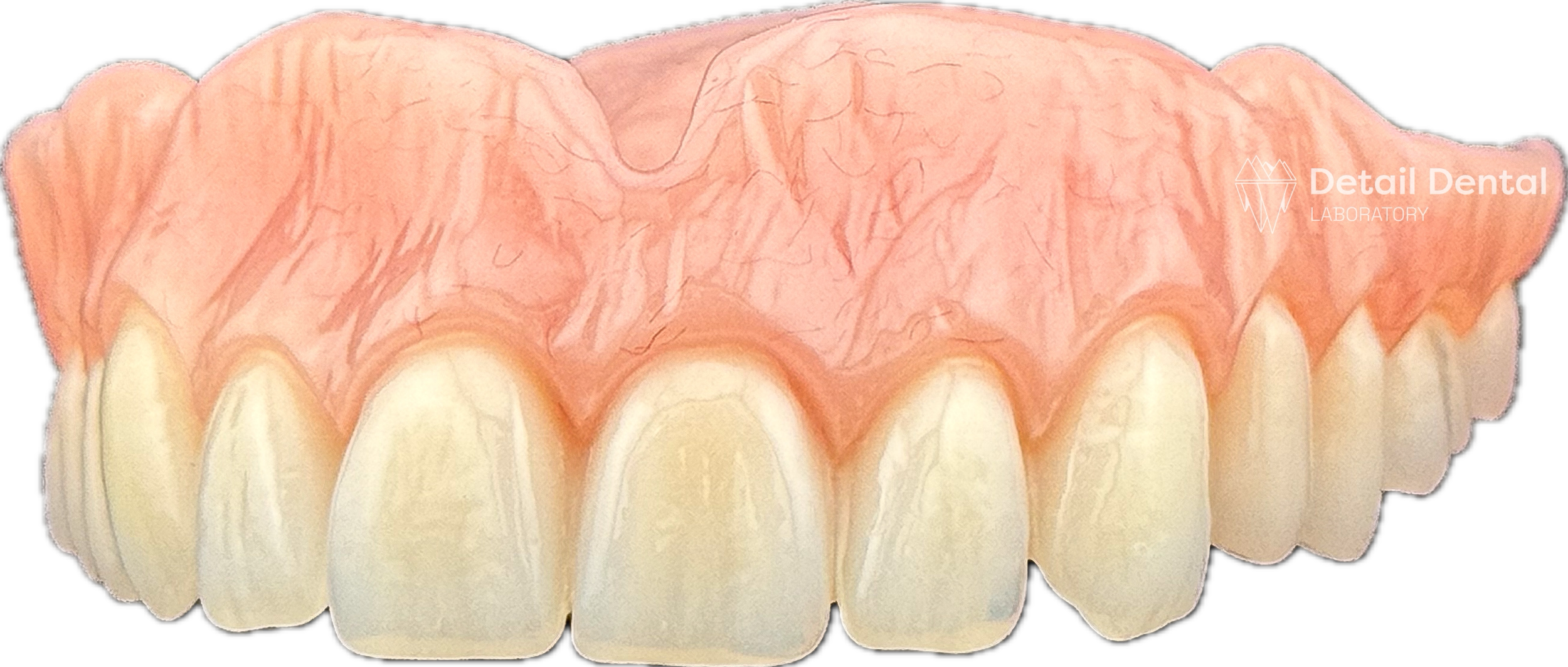Close-up of a dental prosthetic, showing upper teeth and gums, with the logo 'Detail Dental LABORATORY' on the right side.