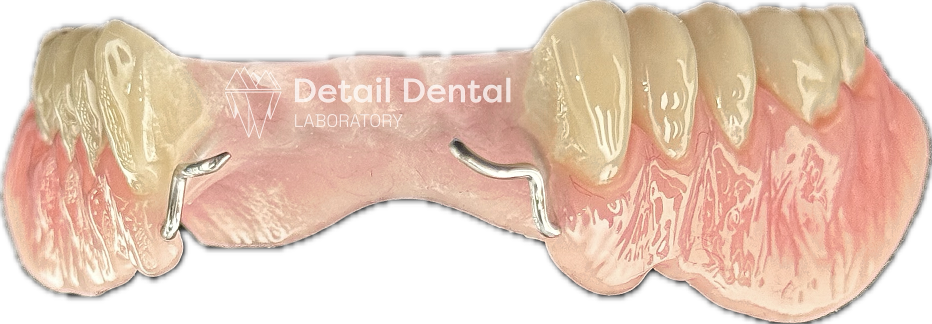 Model of the upper teeth with dental retainers and pink gums, labeled 'Detail Dental Laboratory'.