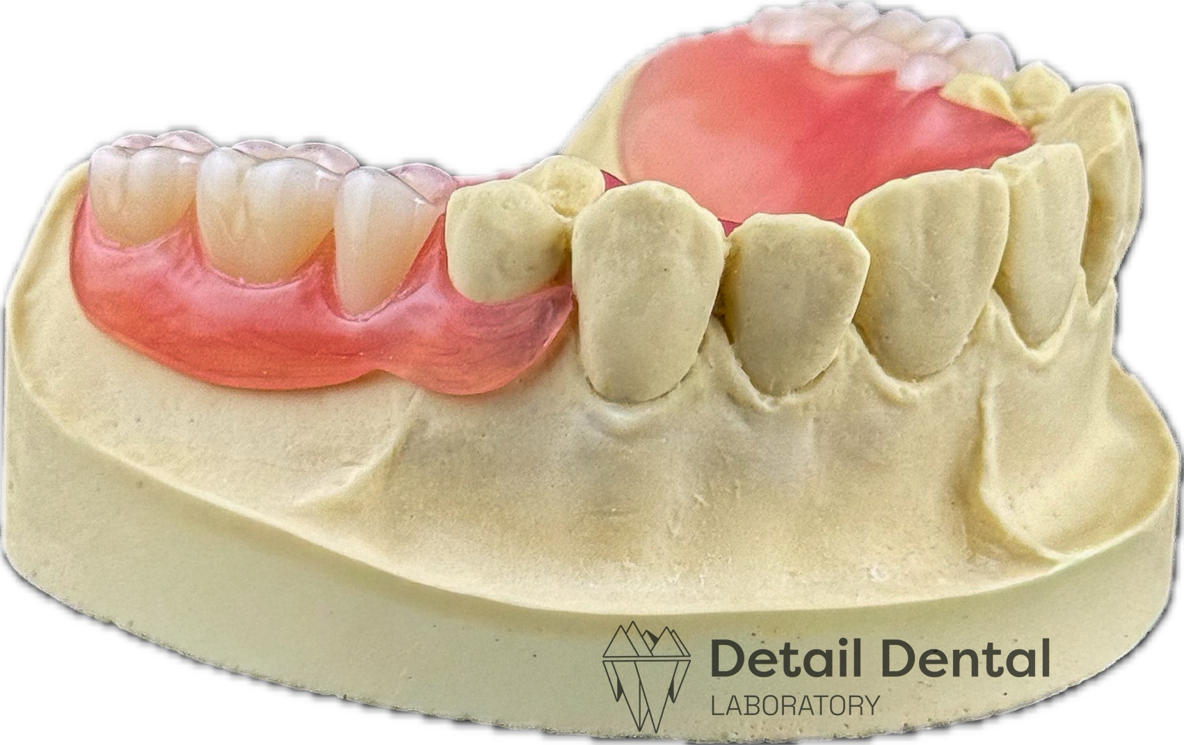 A dental model showing teeth with some crowns and a pink gum-colored base, with a black background and the logo of Detail Dental Laboratory.