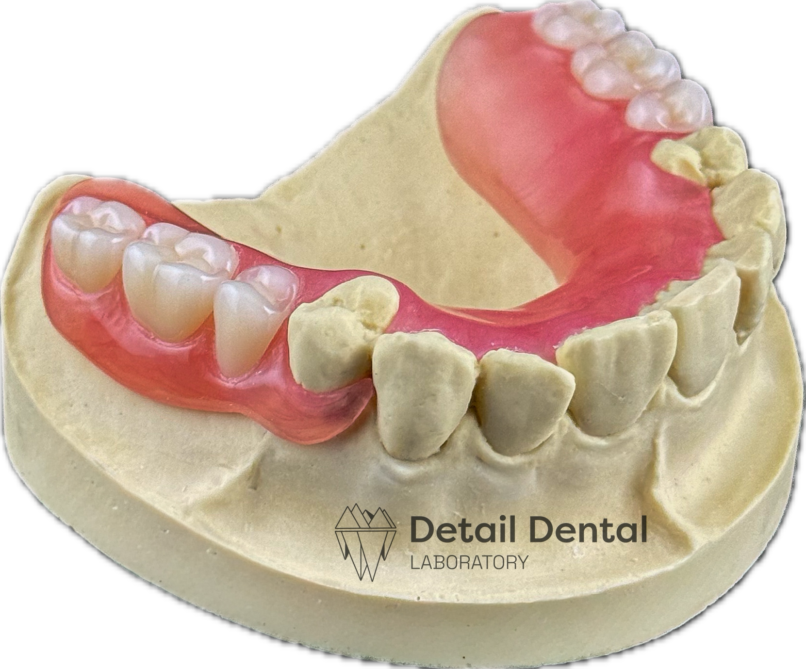 Dental model showing upper and lower teeth, with gums and soft tissues, from Detail Dental Laboratory.