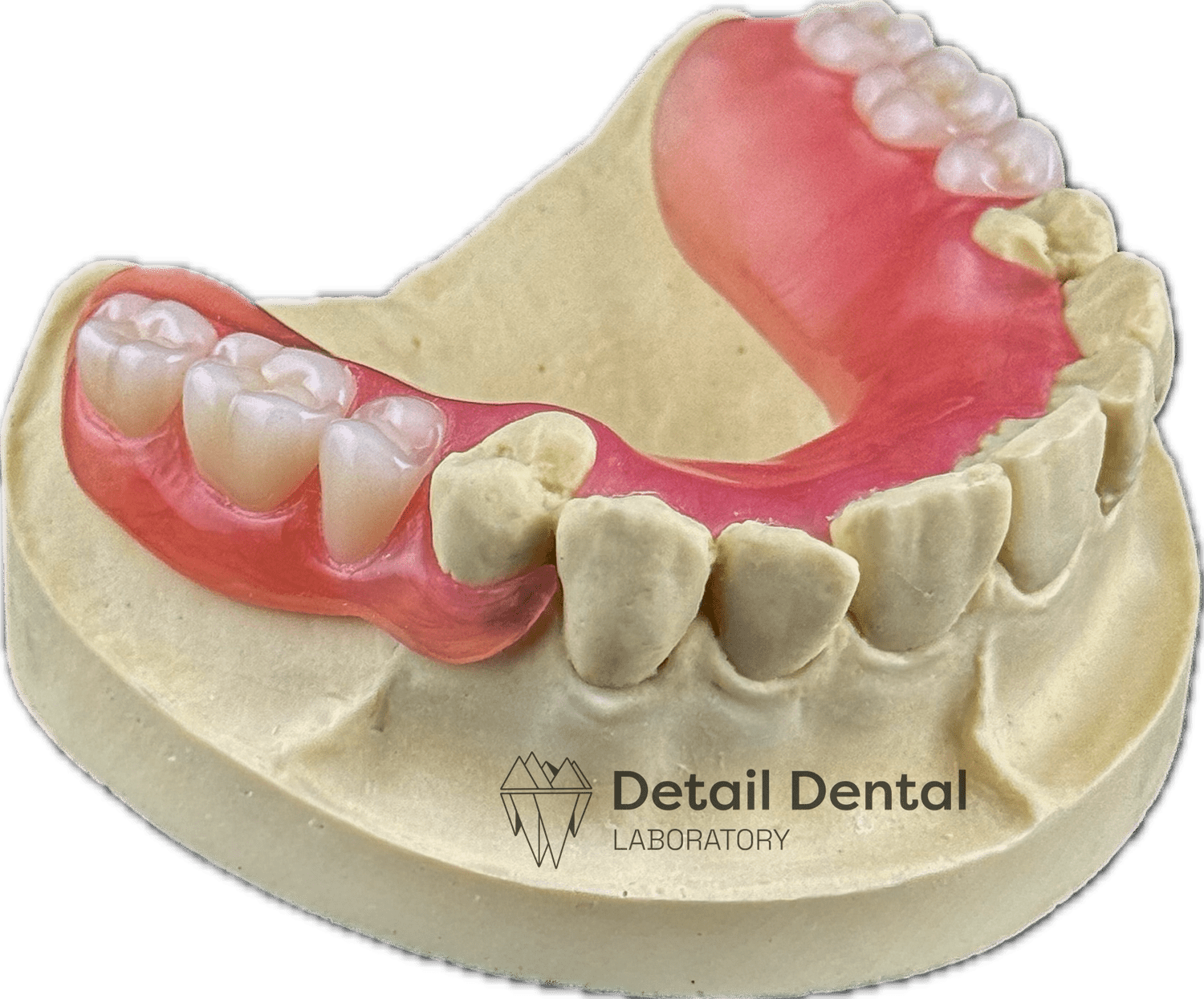 Valplast Based Rpd Valplast Dentures — Detail Dental Laboratory