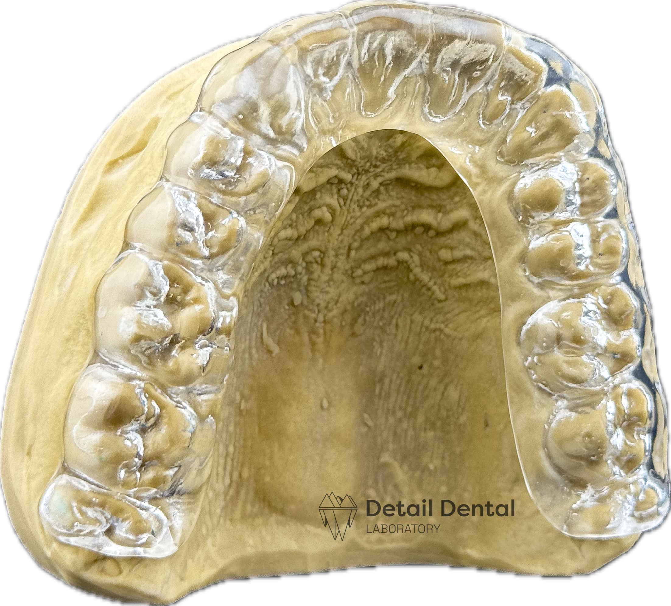 Close-up of a dental model with a clear aligner on a yellowish dental impression model, used for orthodontic treatment