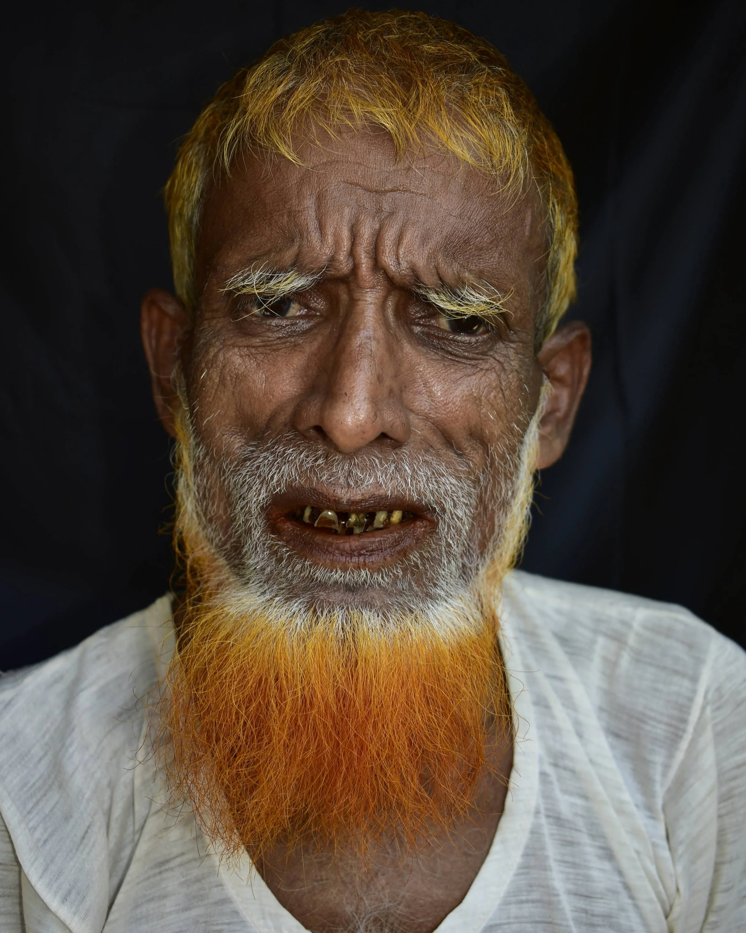 An elderly man with yellow dyed hair and a matching beard, showing yellow teeth, wearing a white shirt, with a black background.