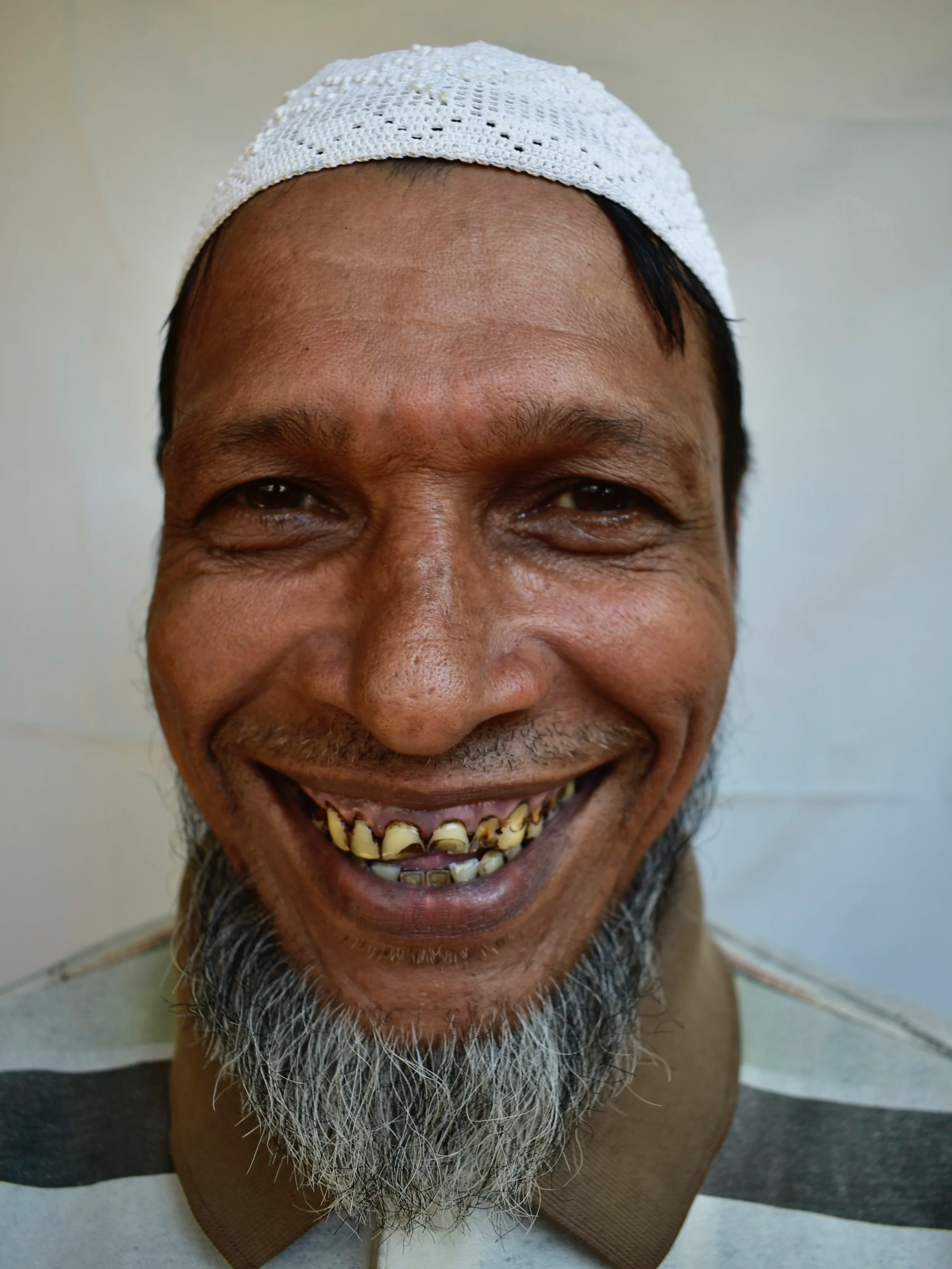 A middle-aged man with a beard wearing a white cap smiling showing his yellow teeth.