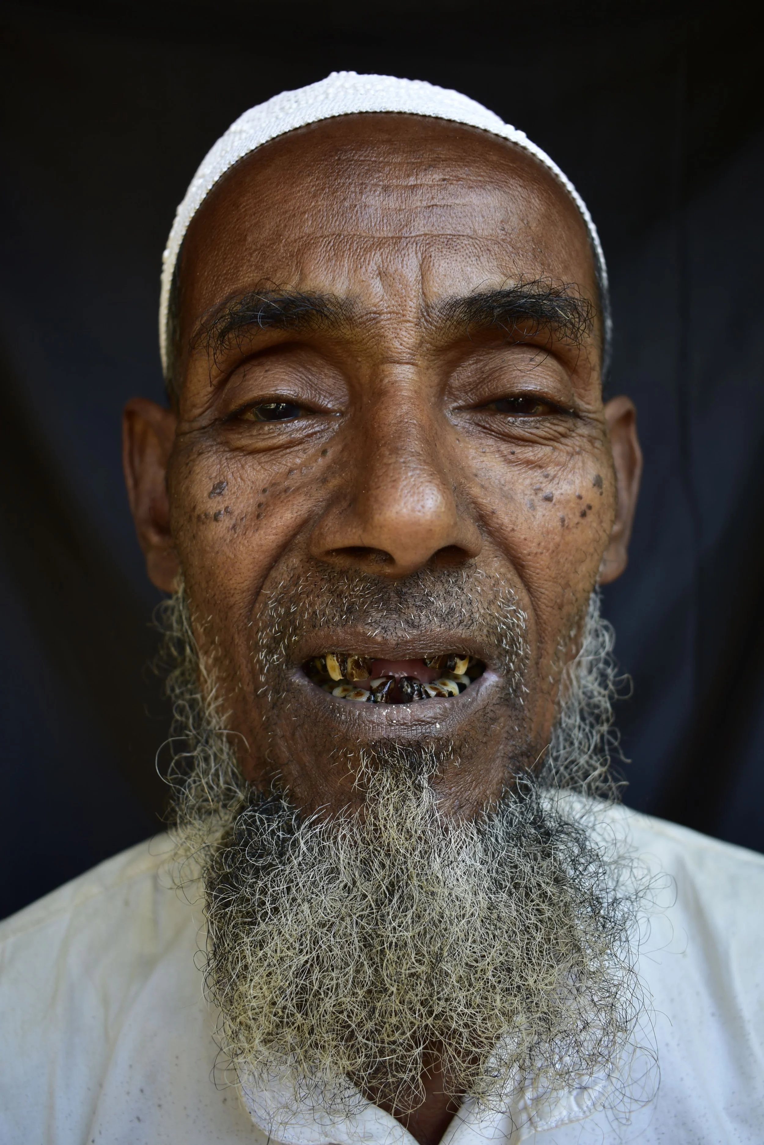 A close-up portrait of an elderly man with dark skin, a white beard, and missing teeth, wearing a white cap and shirt, against a dark background.