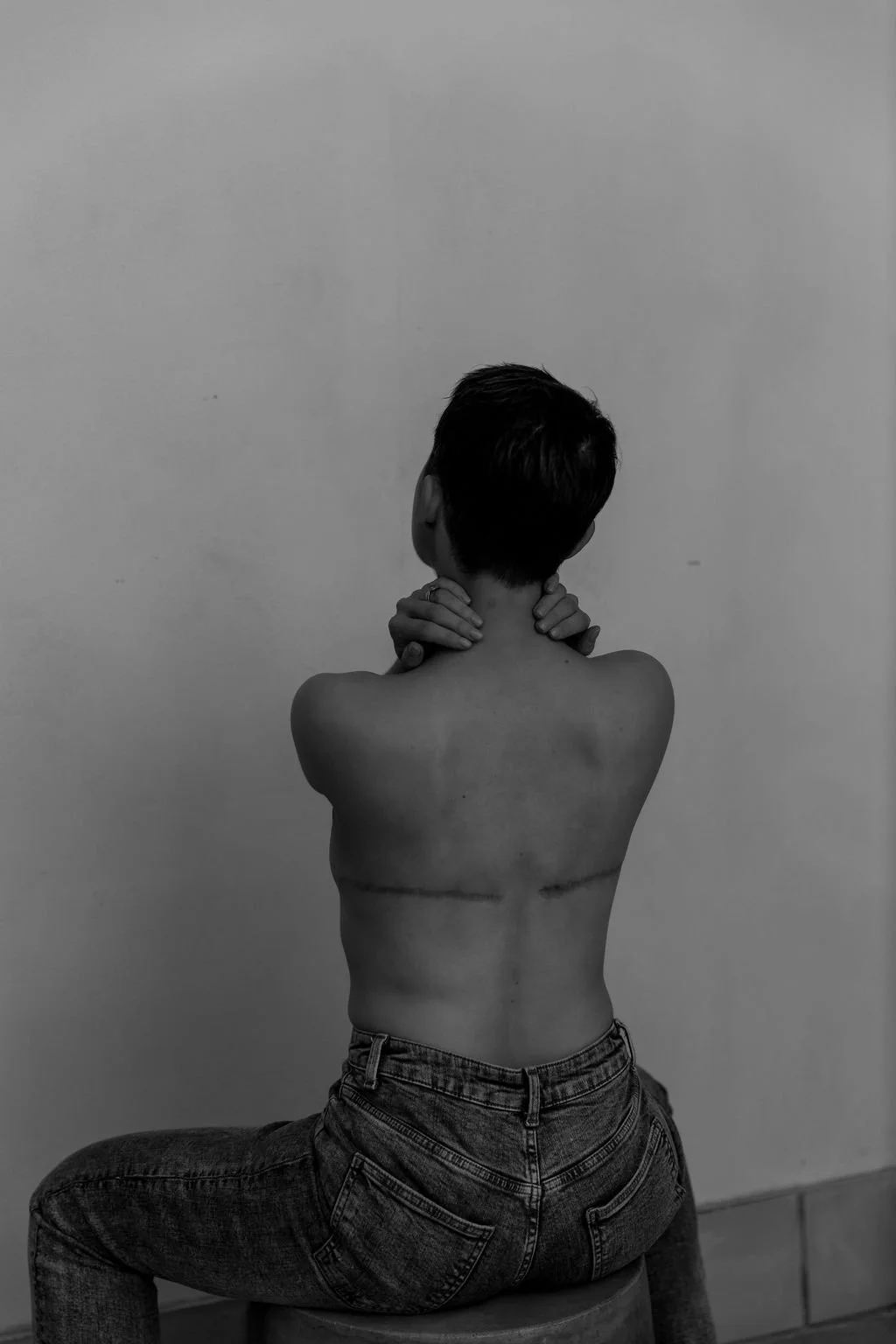 A person with short hair and denim jeans is sitting on a stool against a plain wall, with visible scars on their back.