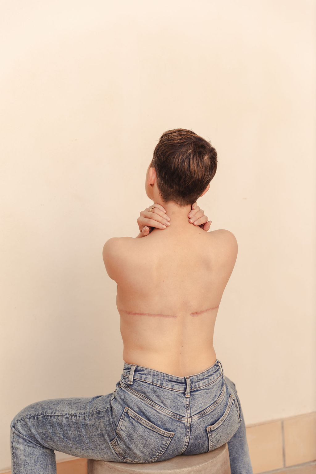 A woman with short hair sitting on a stool, turned away from the camera, holding her neck with both hands, showing her back with two surgical scars.