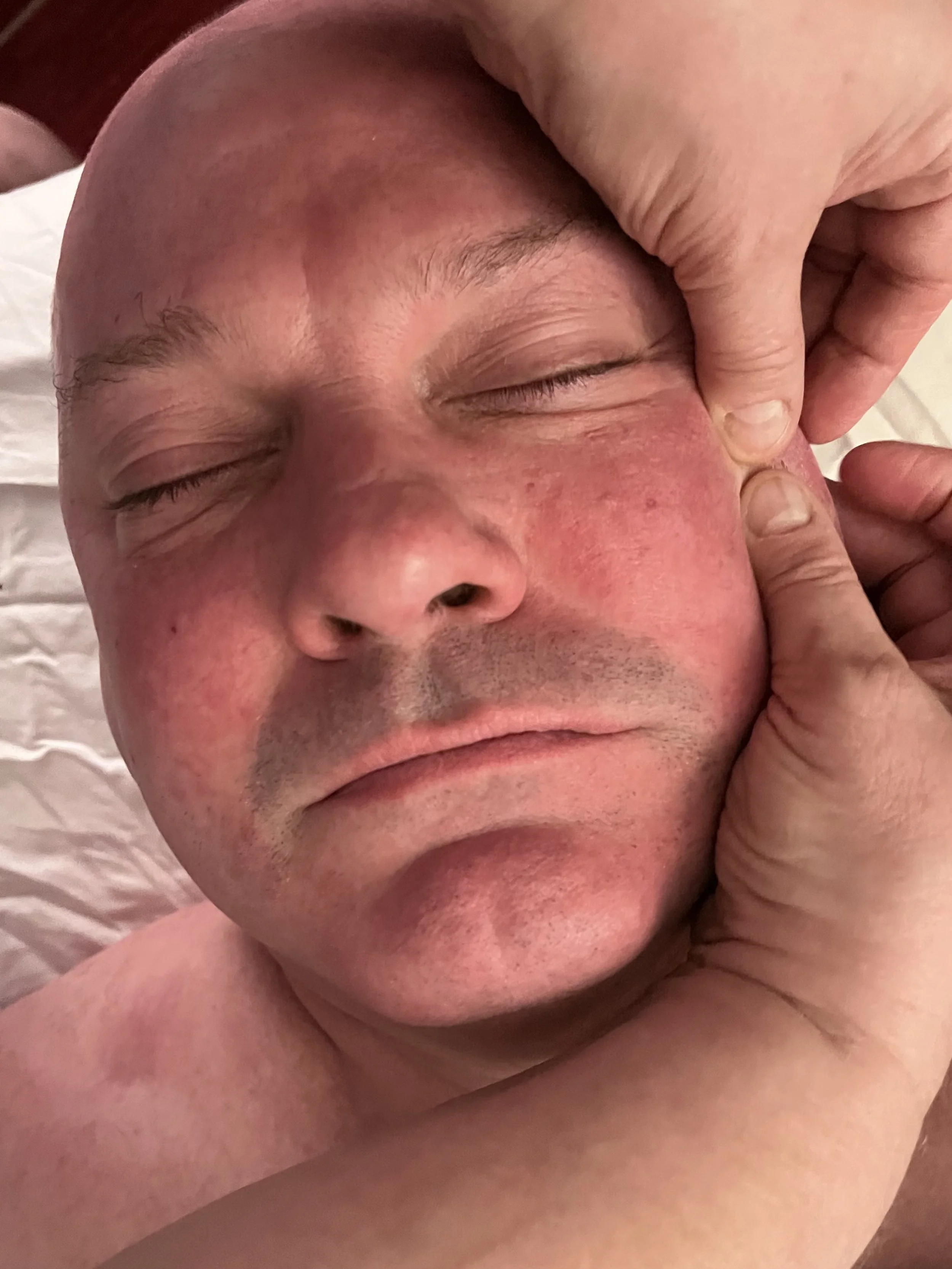 Close-up of a man with a red face receiving a facial massage, with his eyes closed and a relaxed expression.