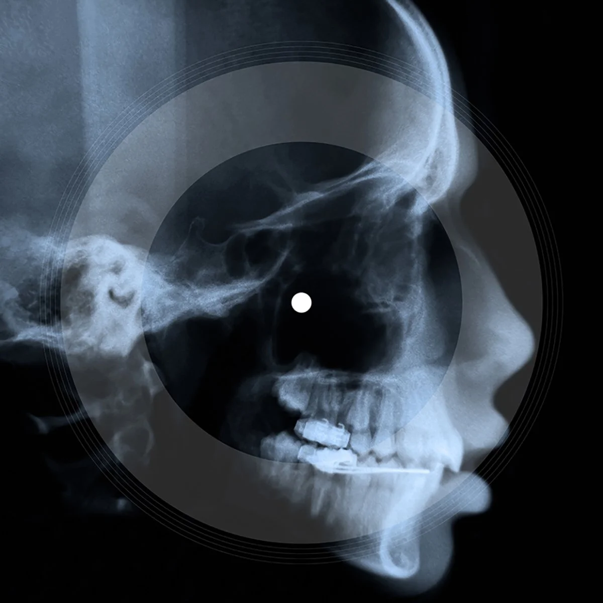 Soundcloud TOMORROW Album Art.jpg