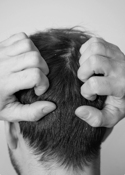 It starts at the scalp