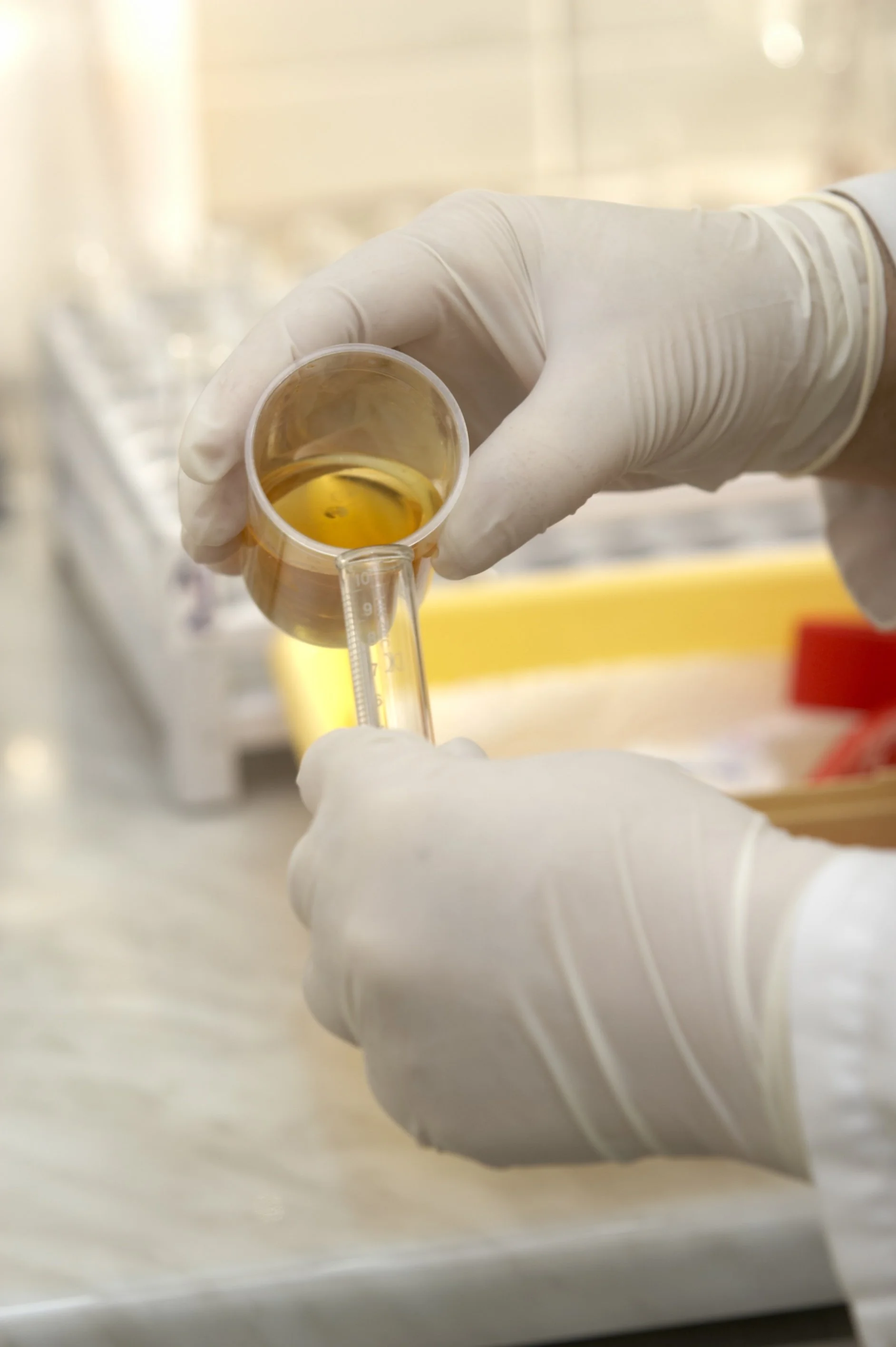 What Is Employer Drug Testing?