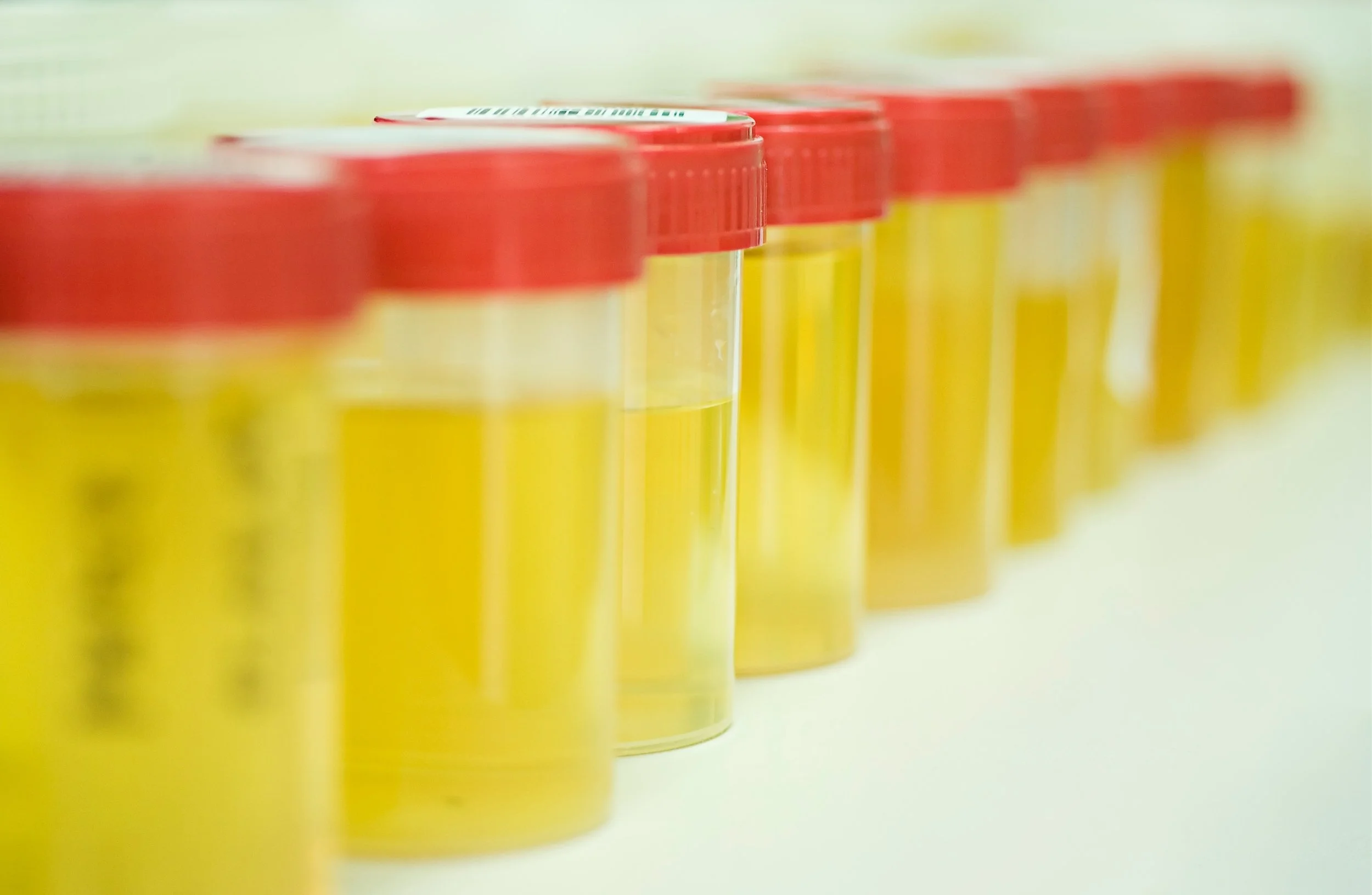 What Is the Difference Between DOT and Non-DOT Drug Testing?