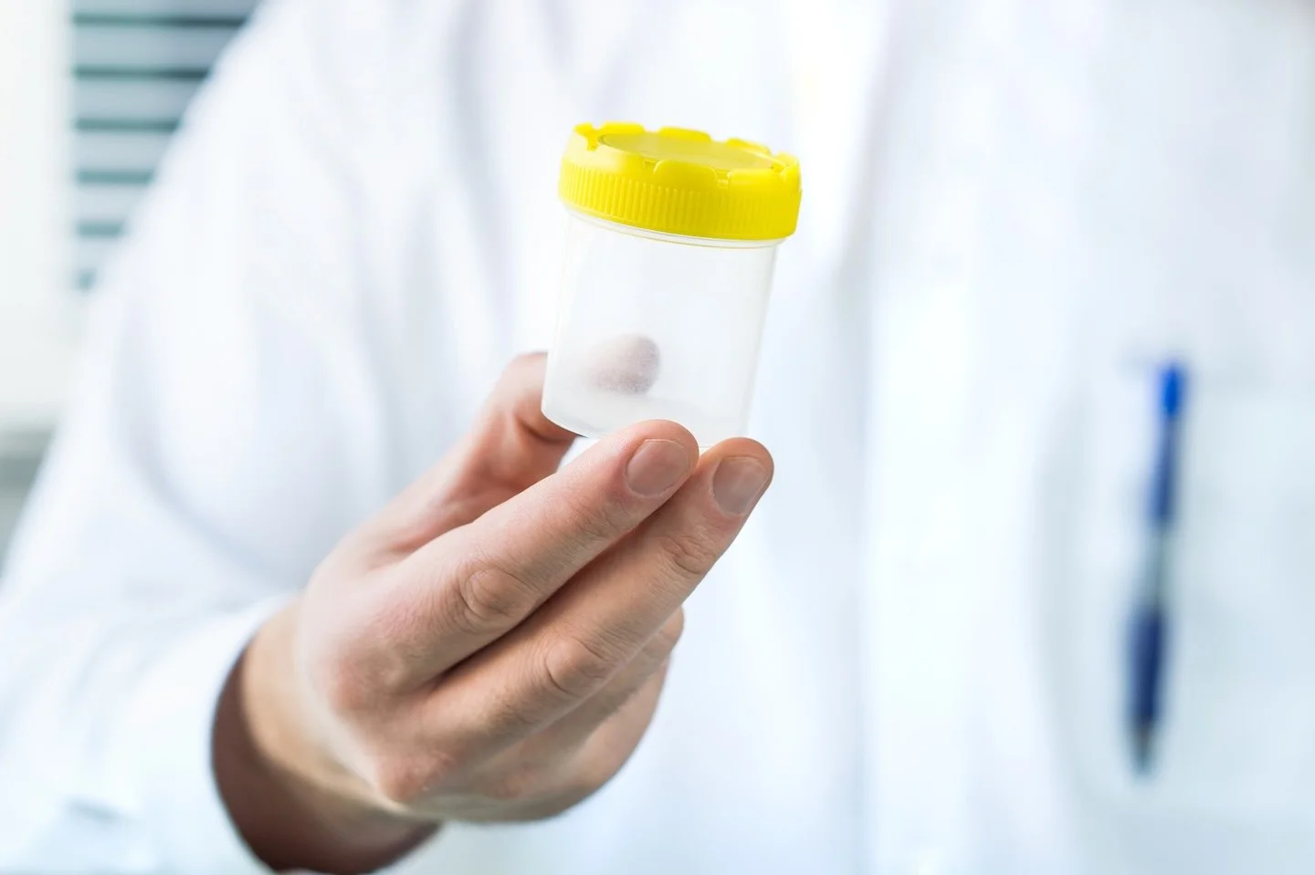 Why Is Random Drug Testing Effective for Employers?