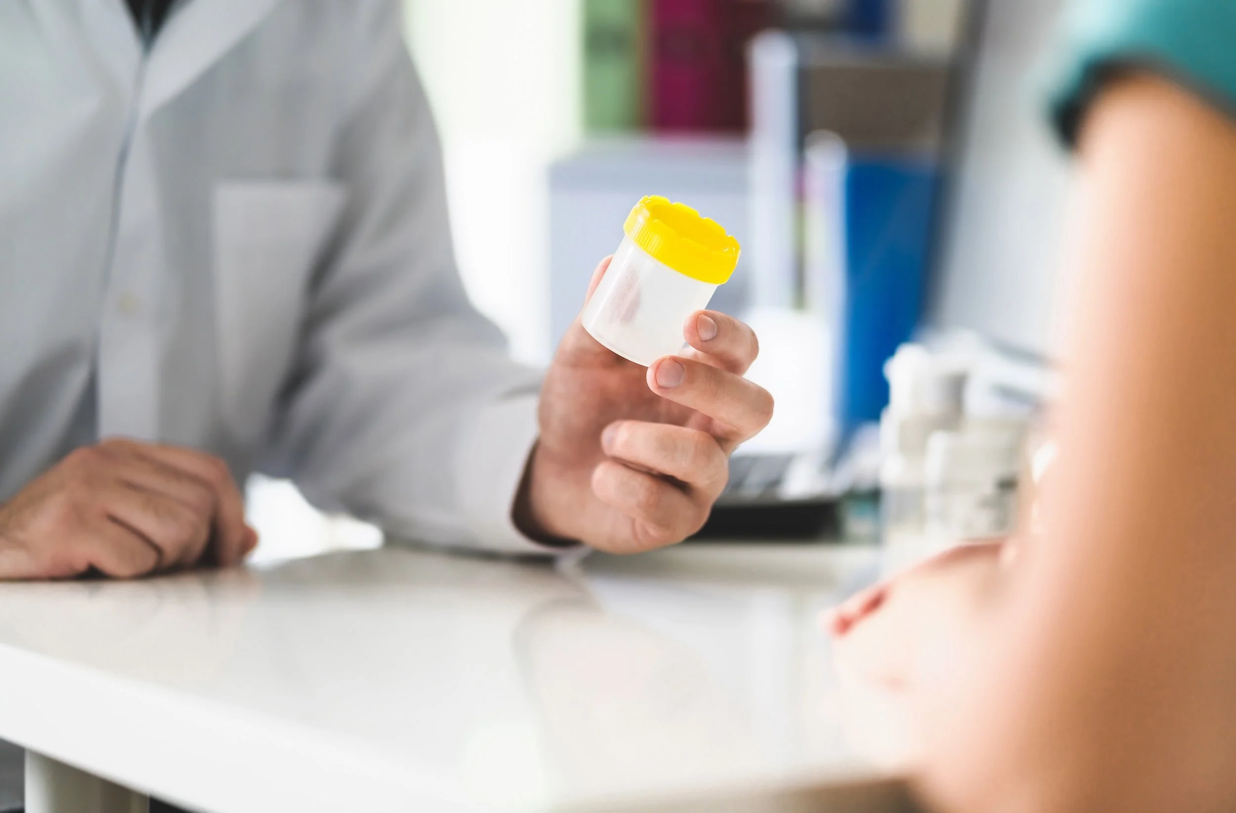 How Do Employers Prevent Cheating on Drug Tests?