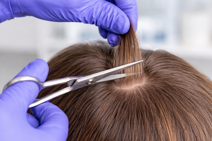 A person wearing purple gloves is cutting brown hair with scissors on a person's scalp.