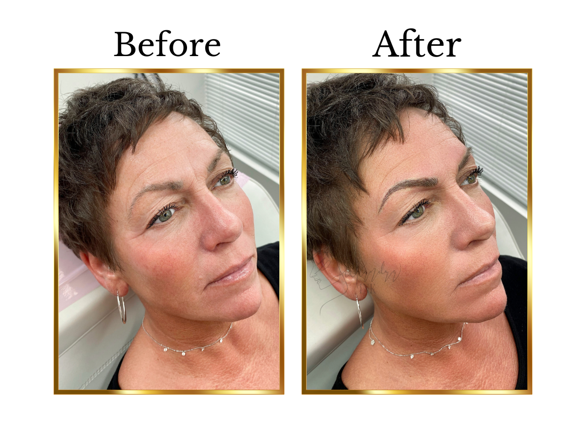 Before and after nano hairstroke eyebrow treatment on a mature client with fair skin and defined facial features, showing sparse natural brows enhanced with soft, realistic hair-like strokes for improved shape, balance, and definition by Alexandra In