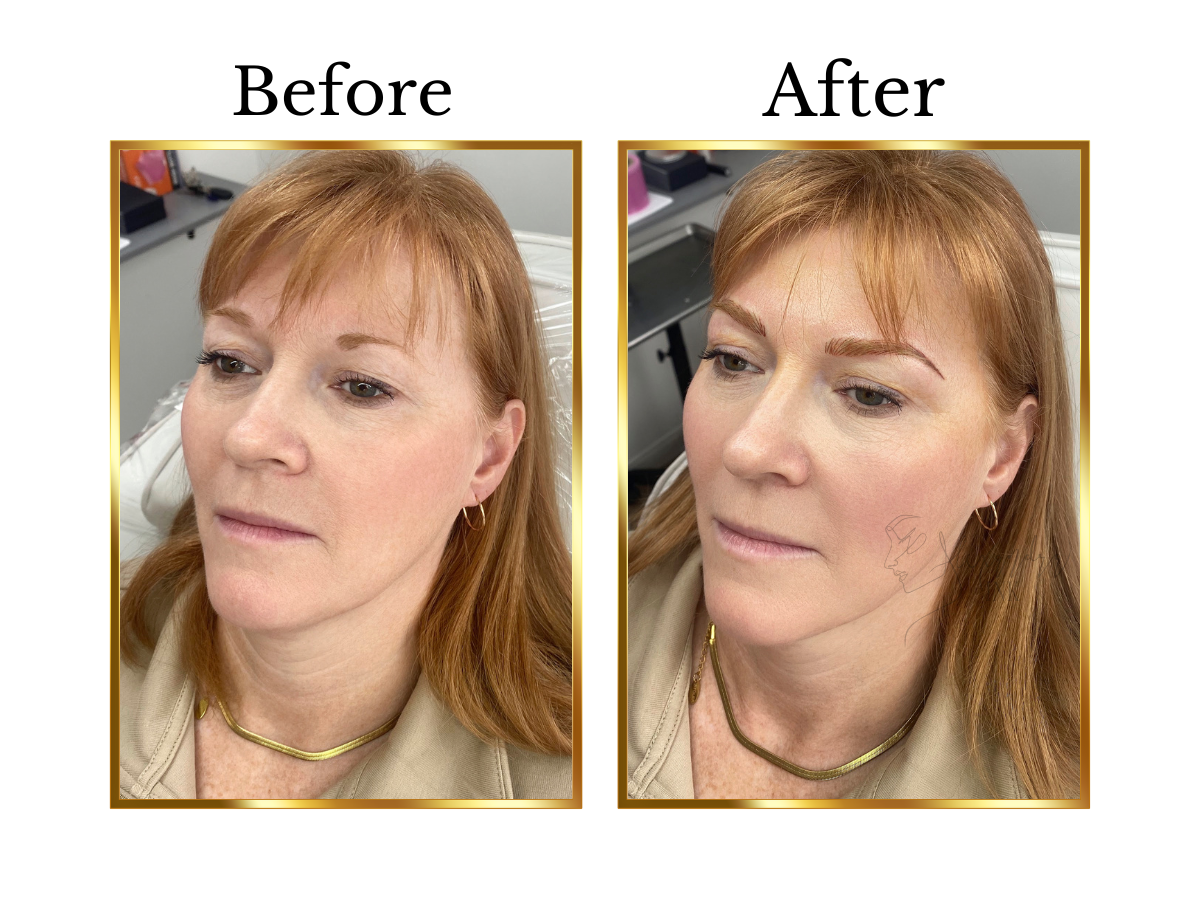 Before and after nano hairstroke eyebrow treatment on a mature client with fair skin and light auburn hair, showing naturally sparse brows enhanced with soft, hair-like strokes for improved definition.