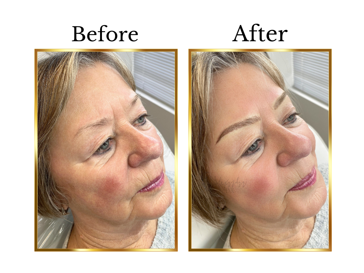 Comparison of a woman's face before and after nano eyebrow service, showing fuller eyebrows after.
