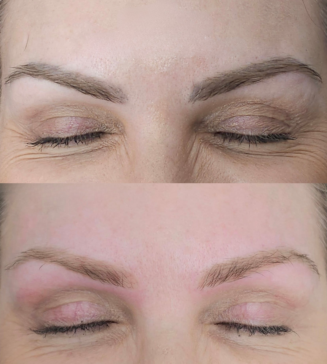Brow tattoo lightening result at Emma McCulloch Tattoo Removal, Everton Park Brisbane
