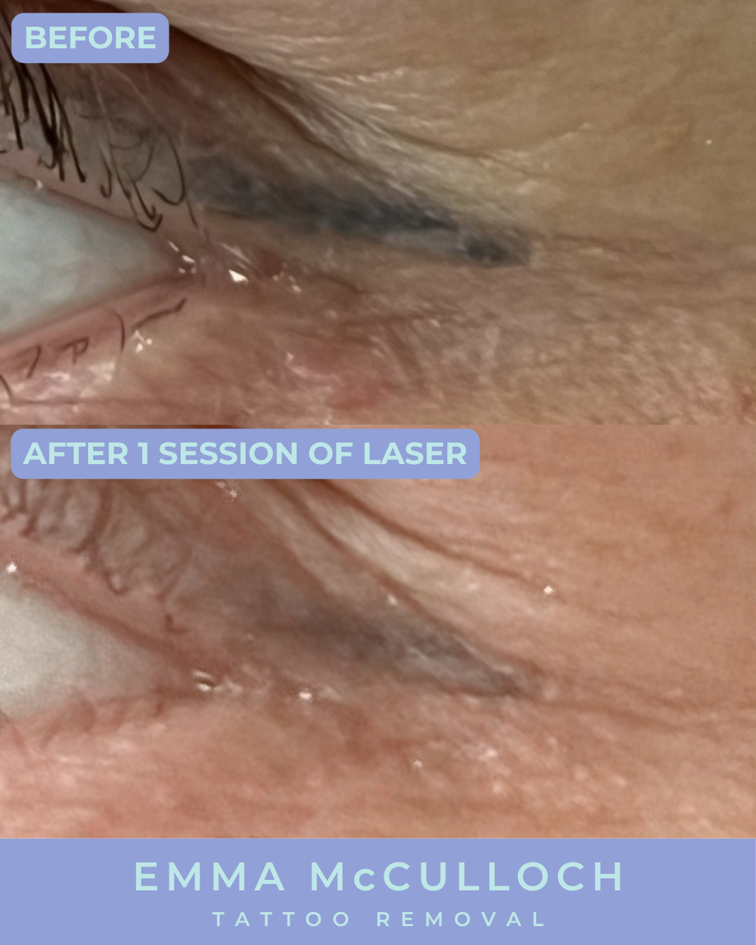 INSTA Eyeliner Before & After  (2).png