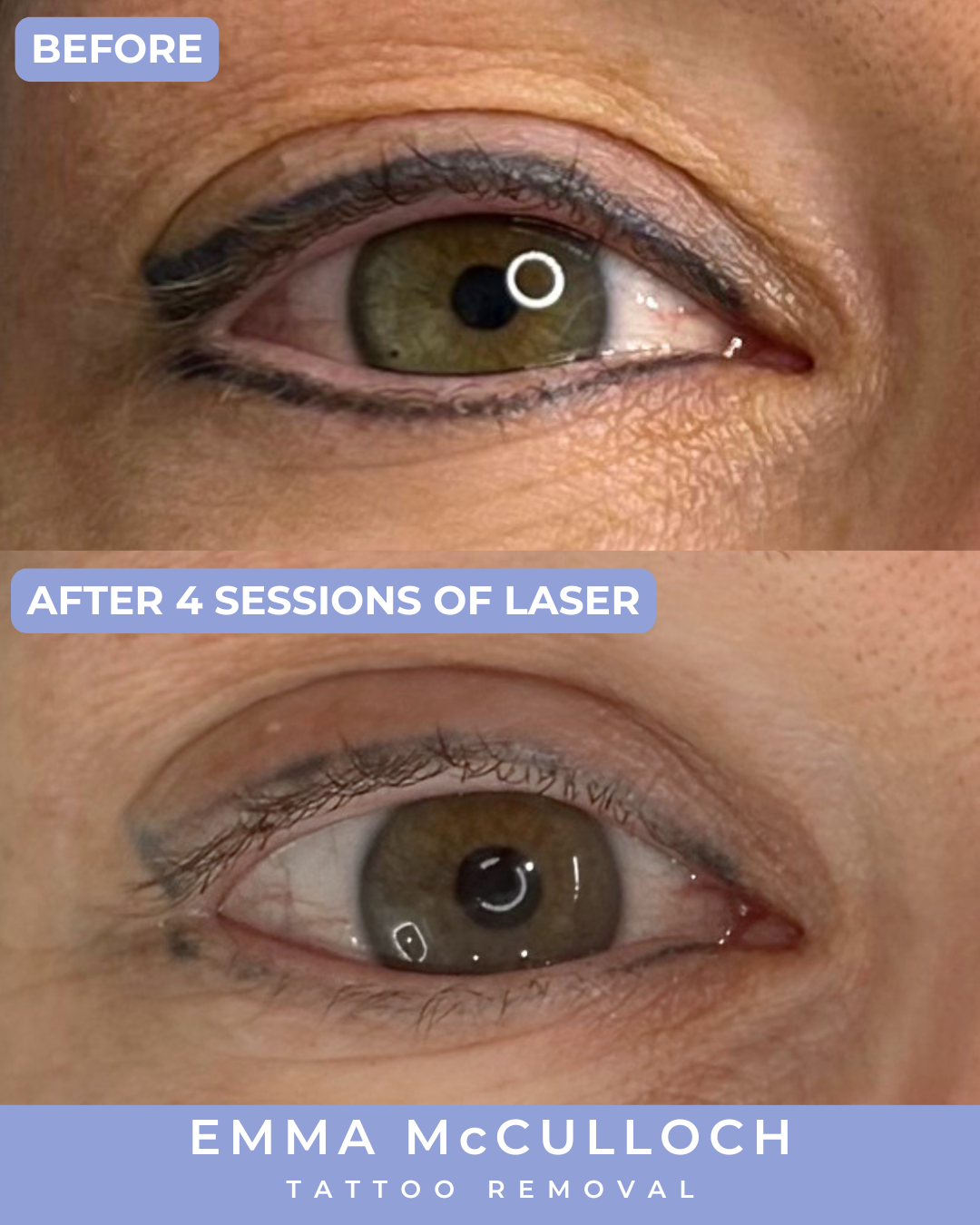 INSTA Eyeliner Before & After  (2).png