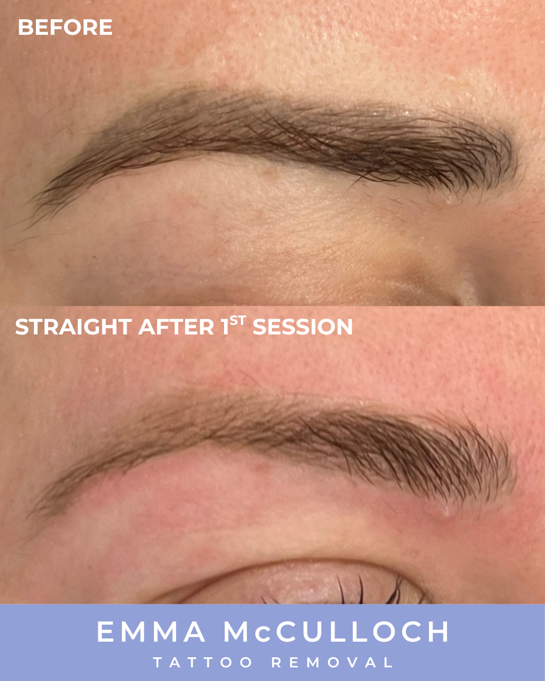 INSTA Brow Before & After .png