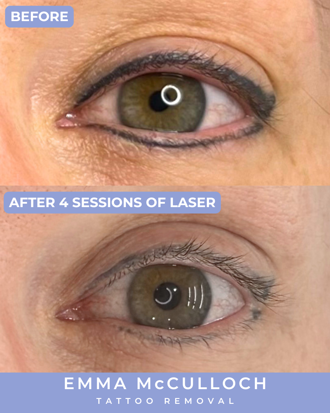 INSTA Eyeliner Before & After  (1).png