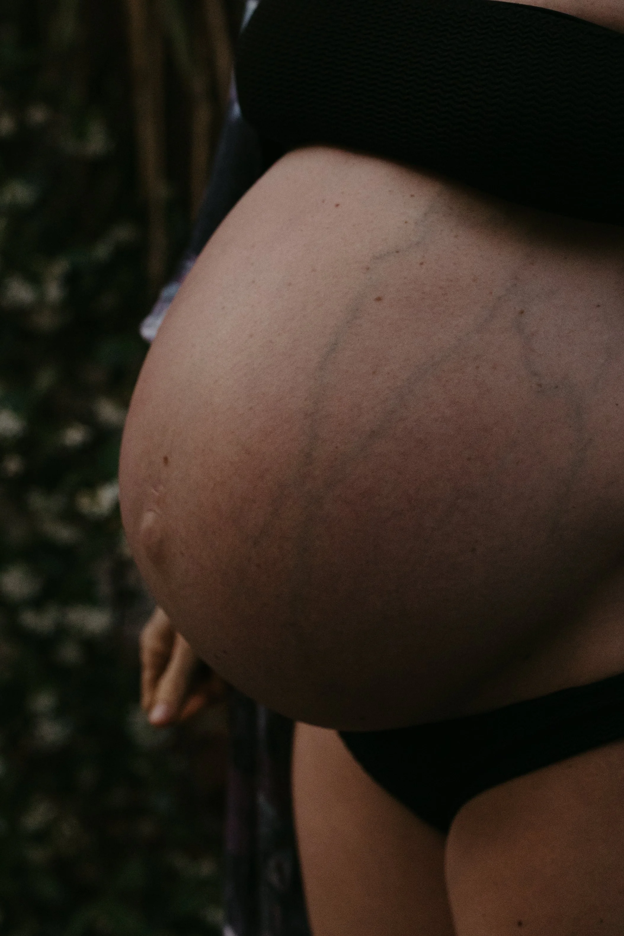 Close-up of a person's thigh and part of their buttocks with visible stretch marks, wearing black shorts.