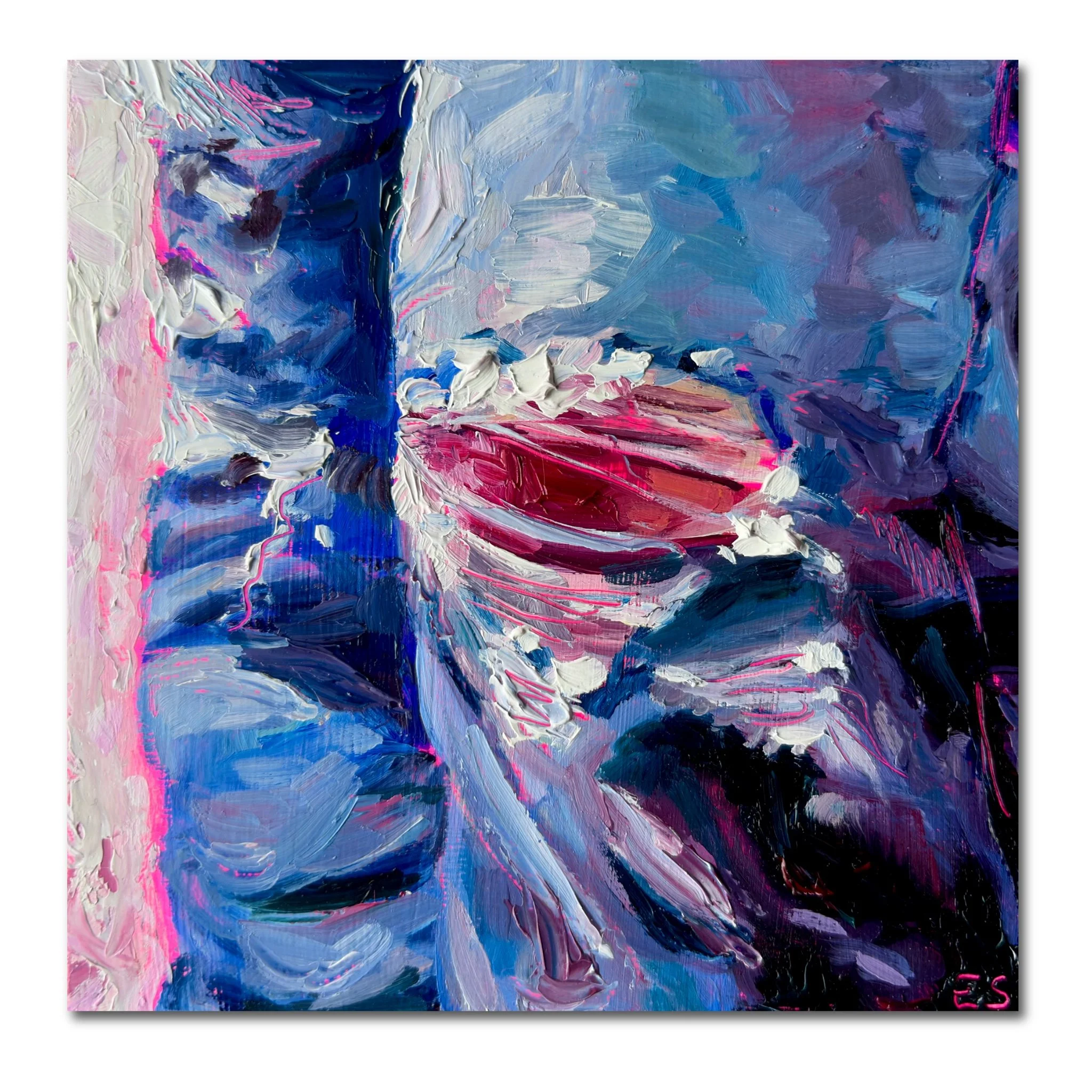 Bruised Knees Through Ripped Jeans — Fine Art Print