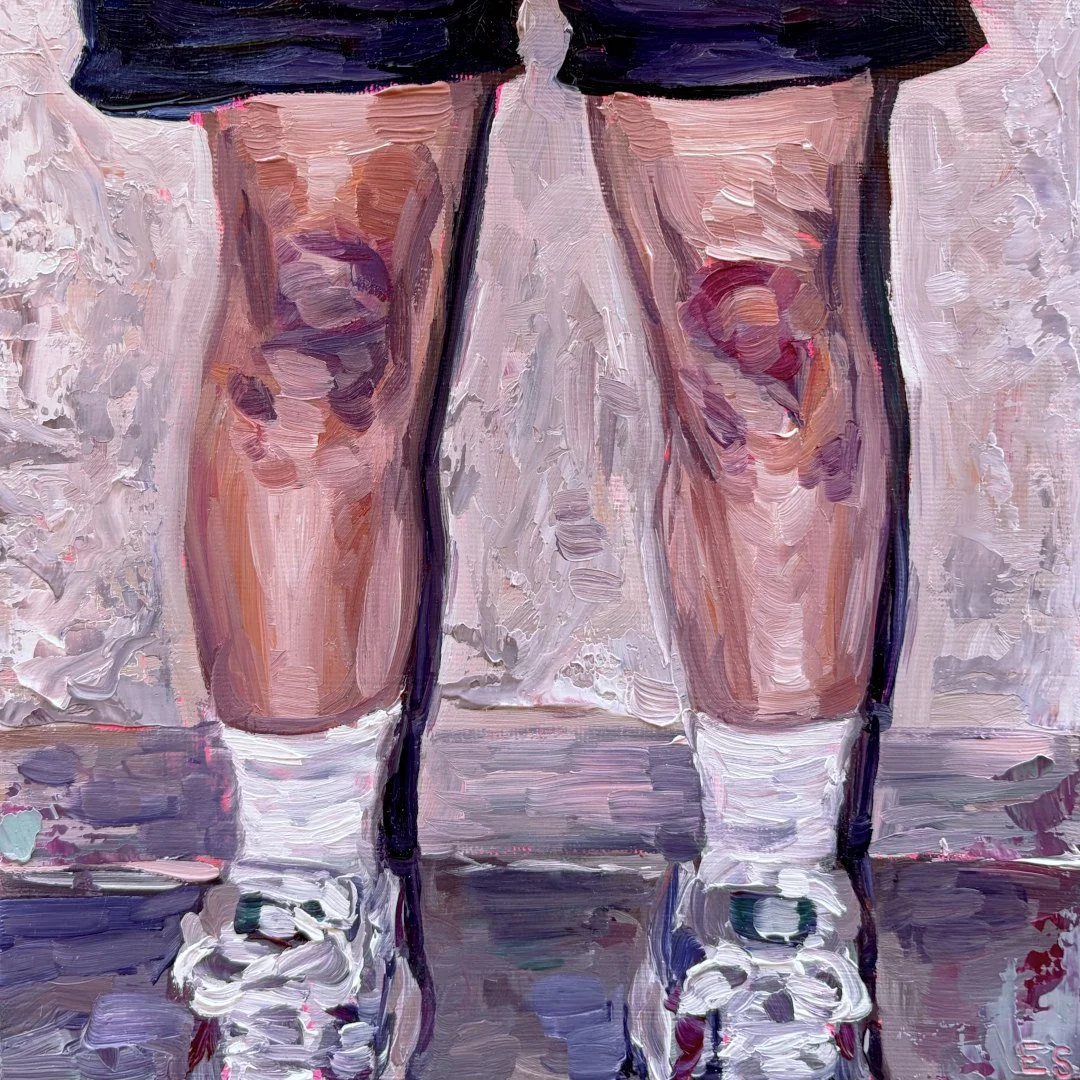 bruised knees - print file WEBSITE.jpg