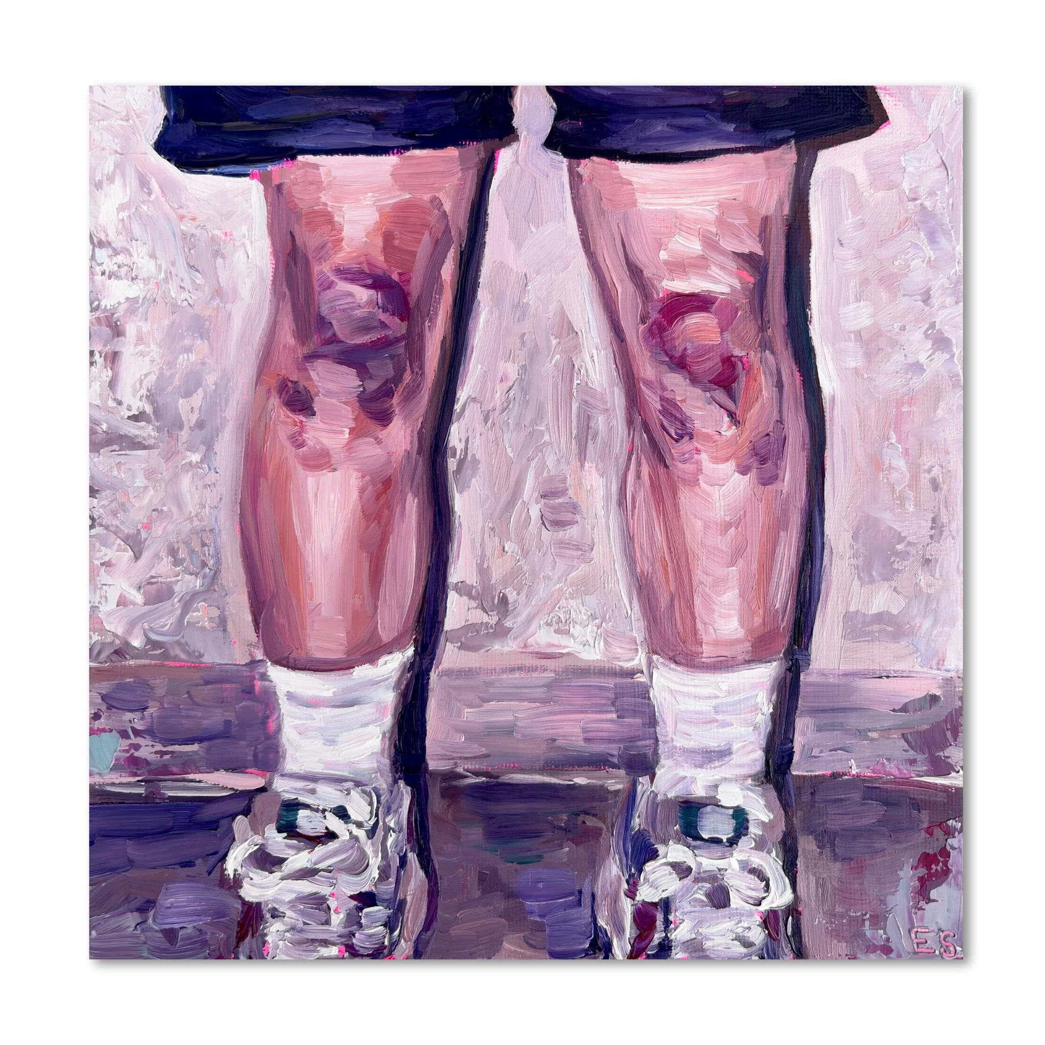 bruised knees — Fine Art Print
