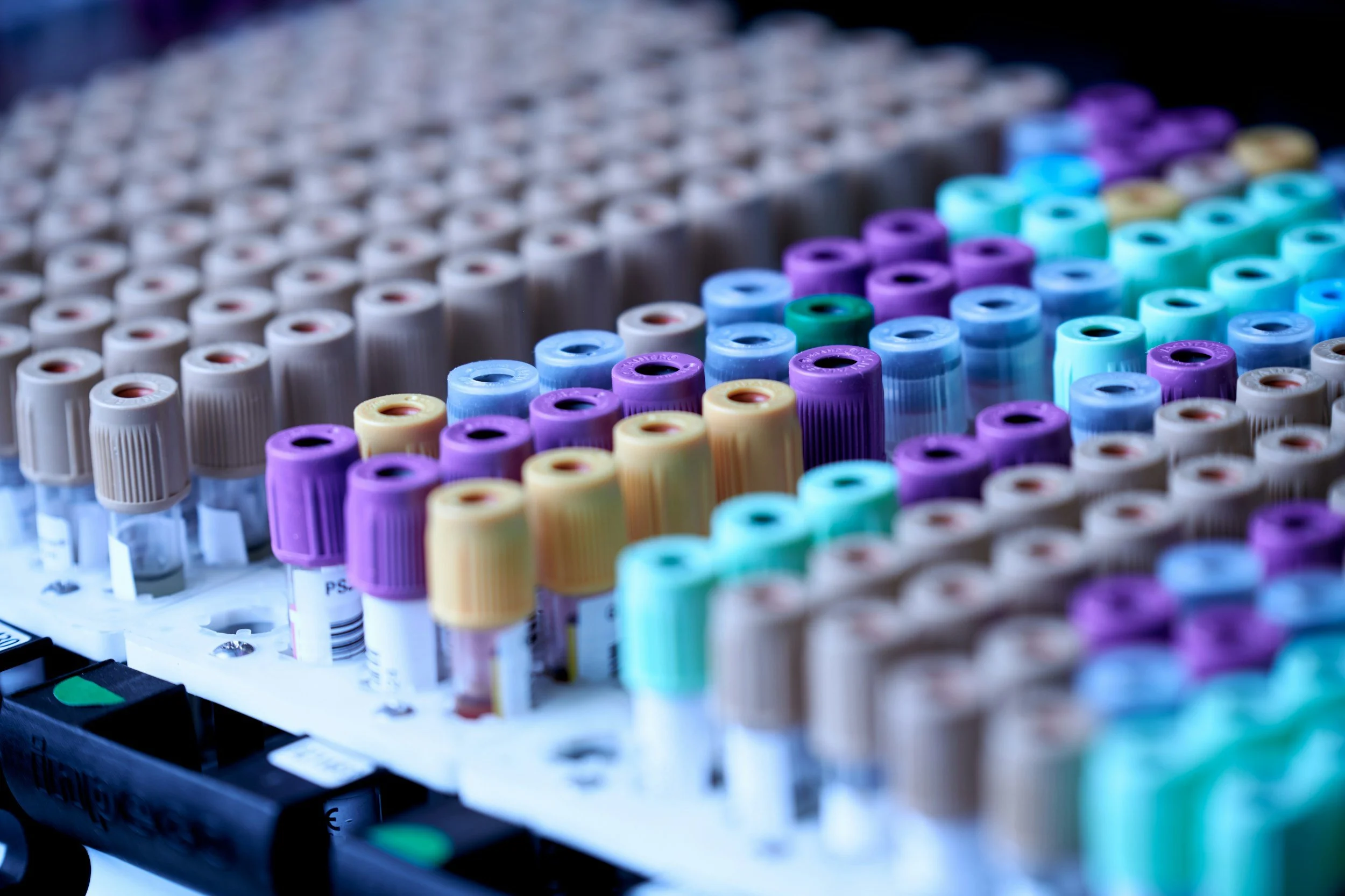 A close-up view of a large number of blood sample collection tubes with colorful caps, organized in a laboratory setting.