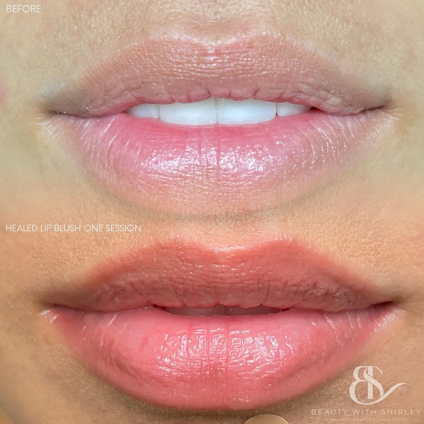 Enhance your natural beauty with a soft, effortless tint that lasts. 

Lip Blush restores color, defines shape, and gives your lips a healthy, polished glow. 

No daily lipstick required.

It&rsquo;s for the woman who values refinement, confidence, a