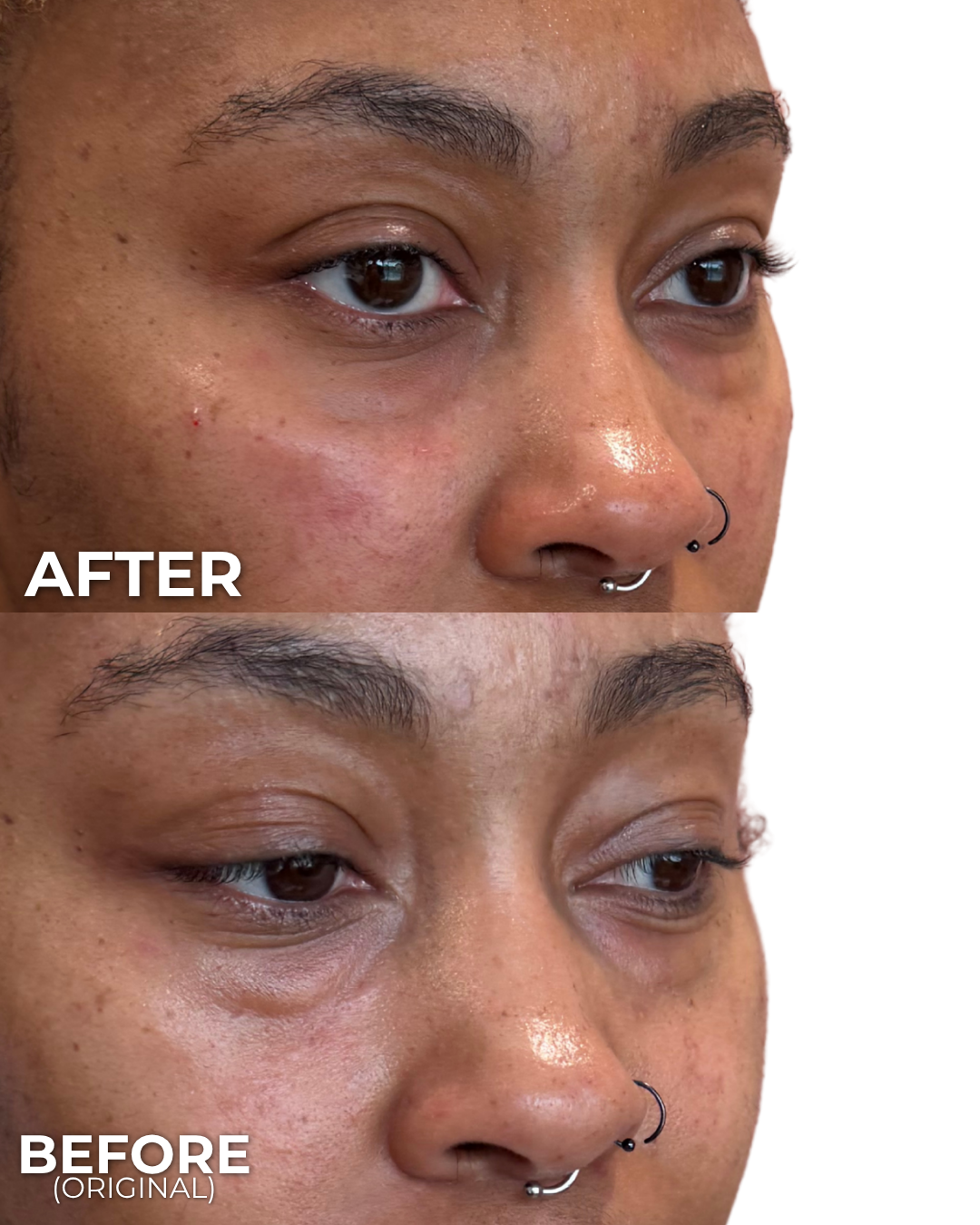 UNDER EYE REJUVENATION.png