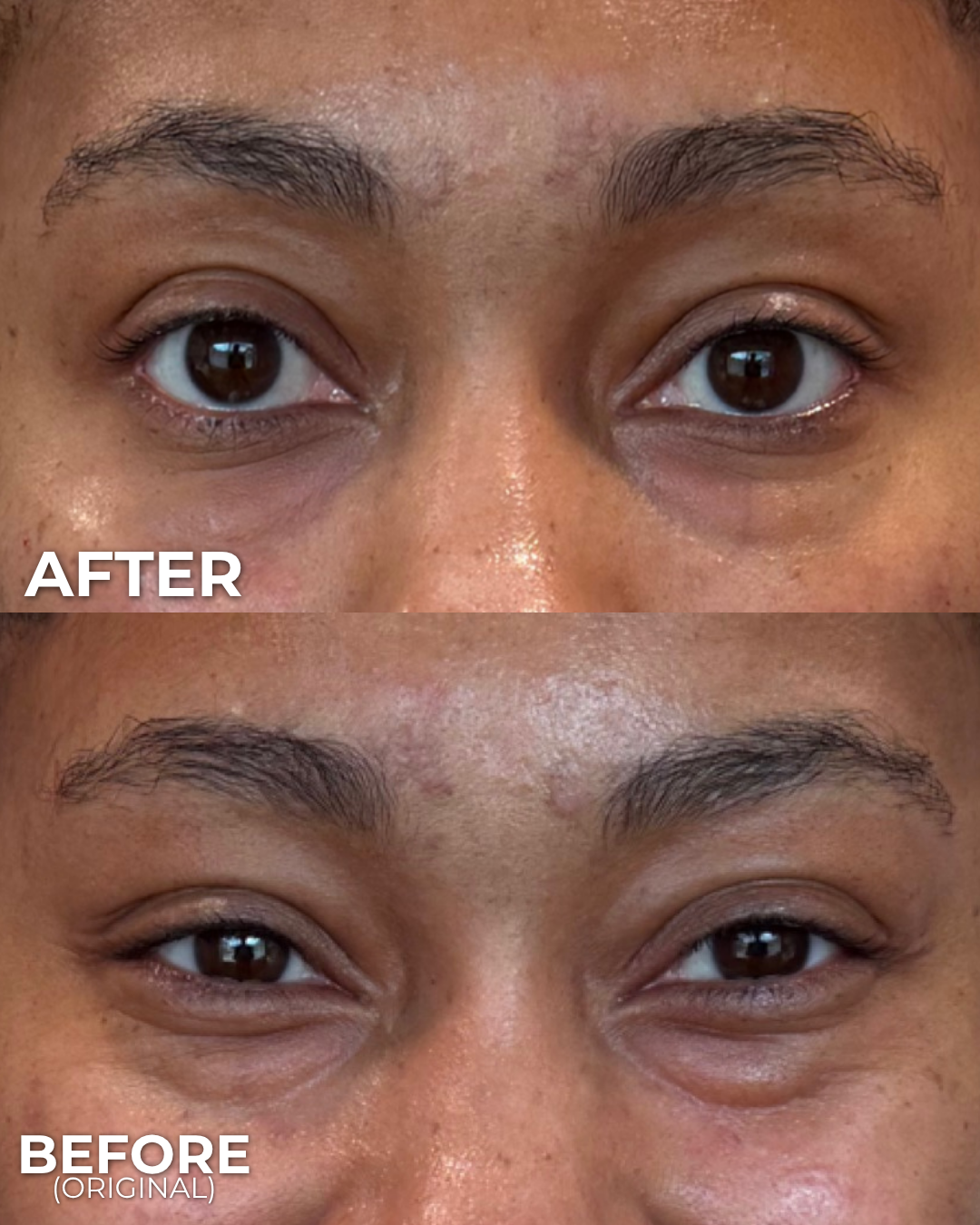 UNDER EYE REJUVENATION (1).png