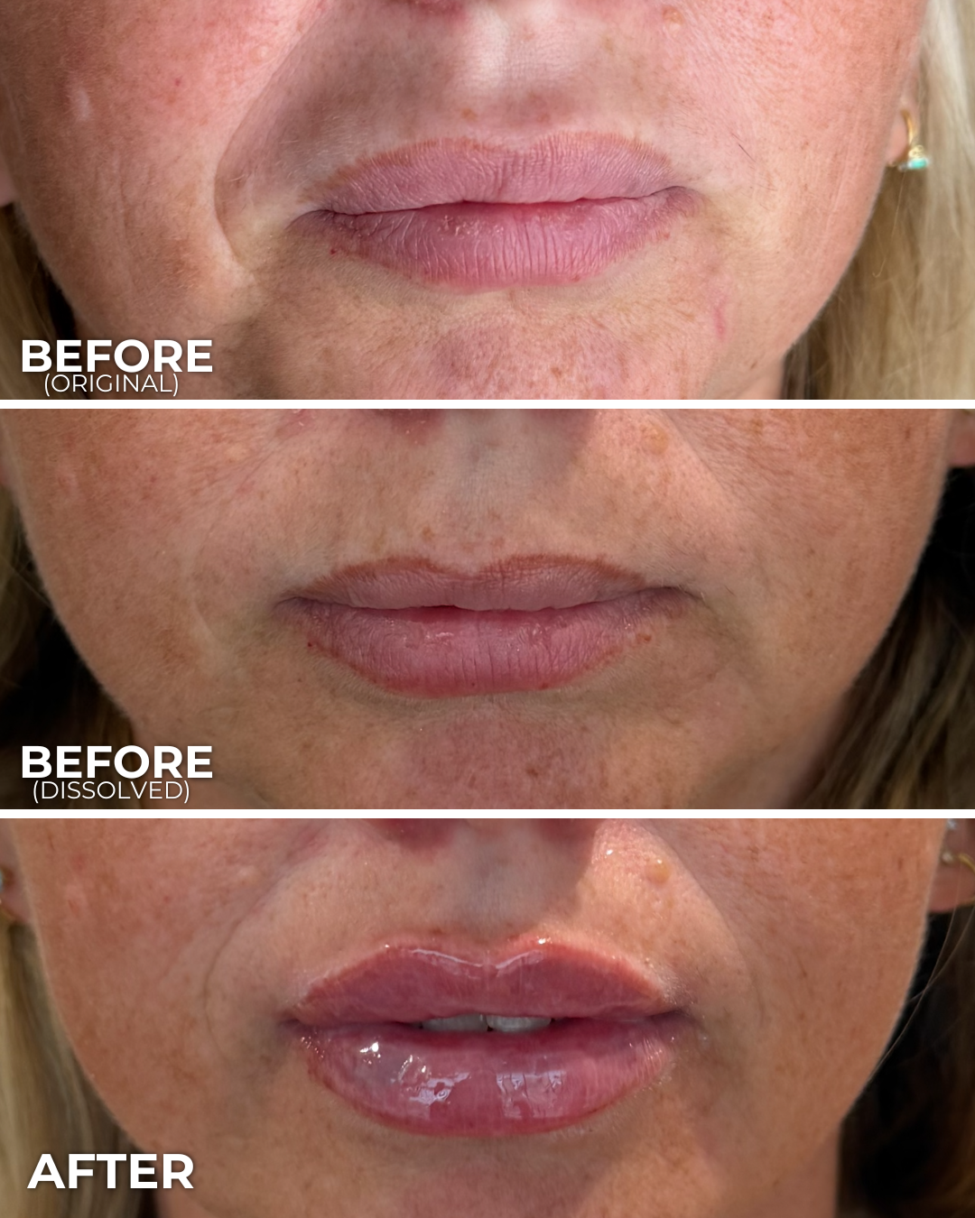 ASHLEY GREEN B&A (1).png