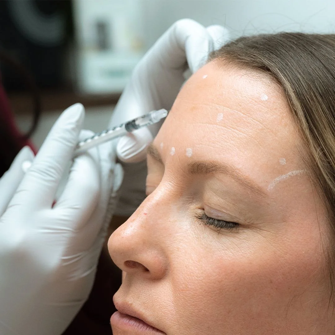 A woman receiving a cosmetic injection in her forehead from a medical professional wearing white gloves.