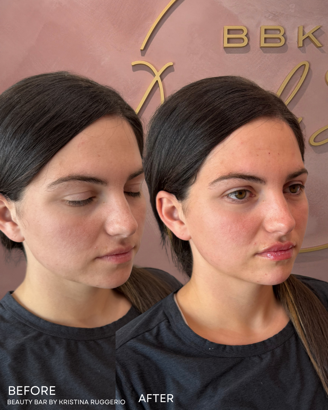 KATE BEFORE & AFTER (1).png