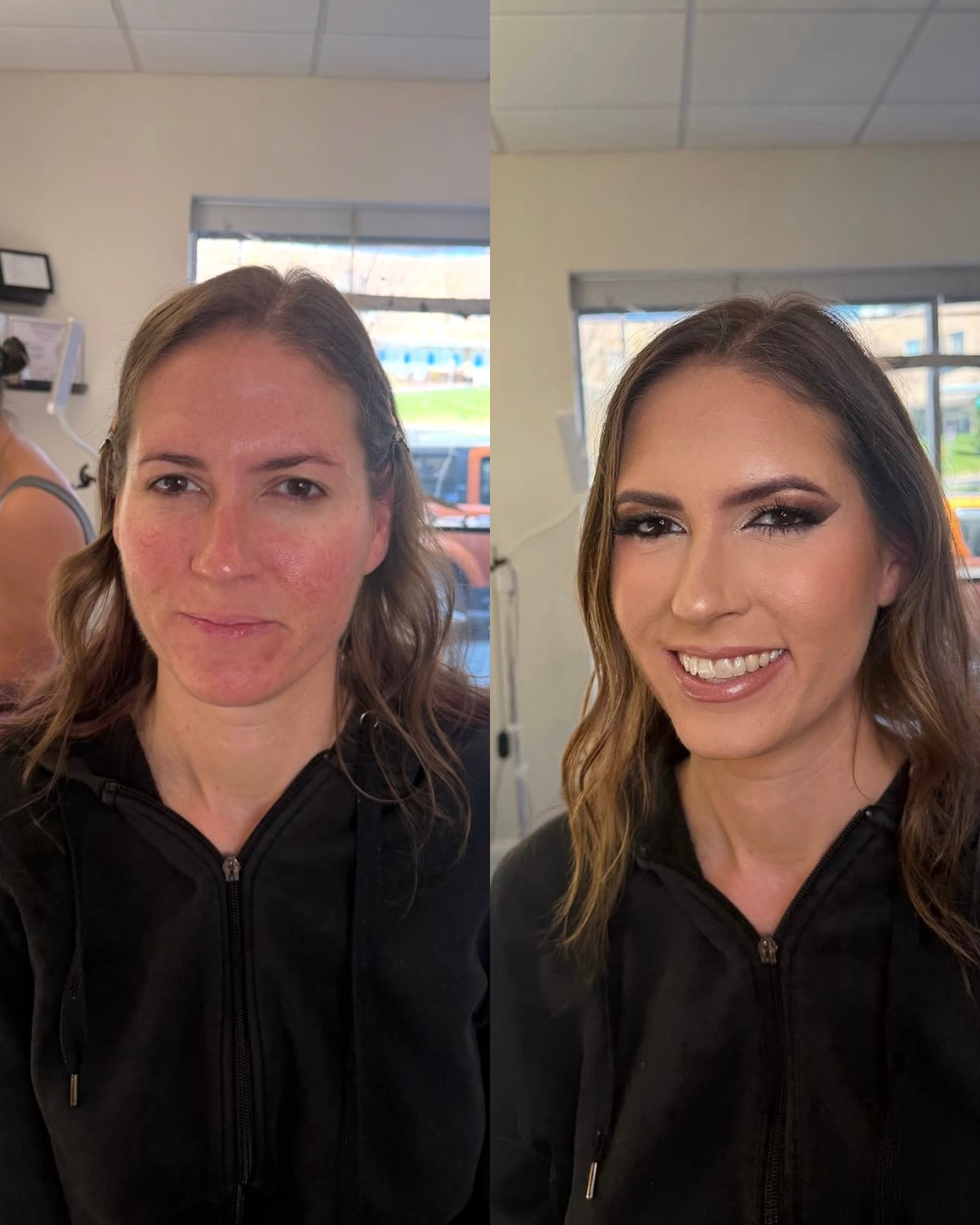 rachel's before and afters for website - 3.png